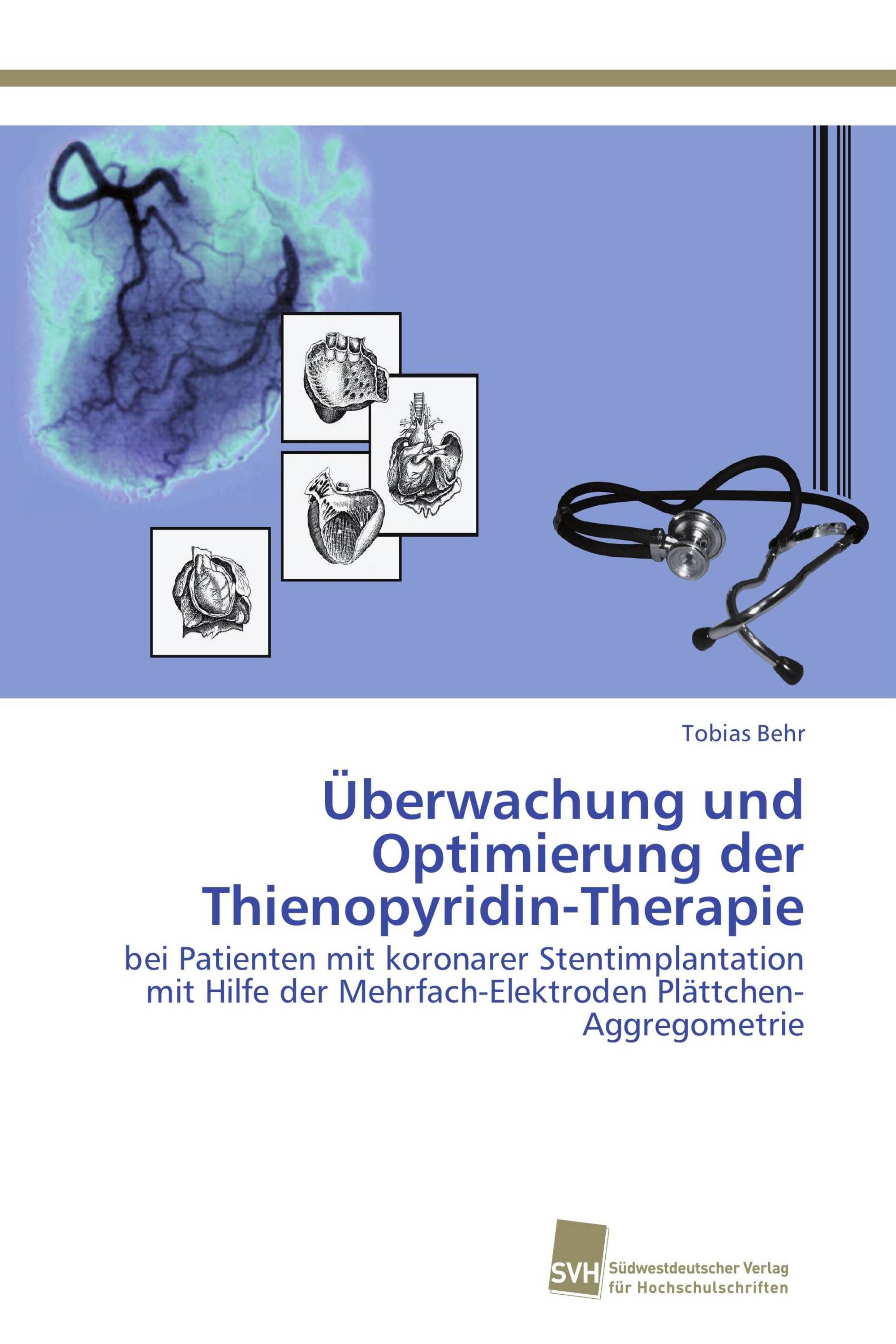 Überwachung und Optimierung der Thienopyridin-Therapie