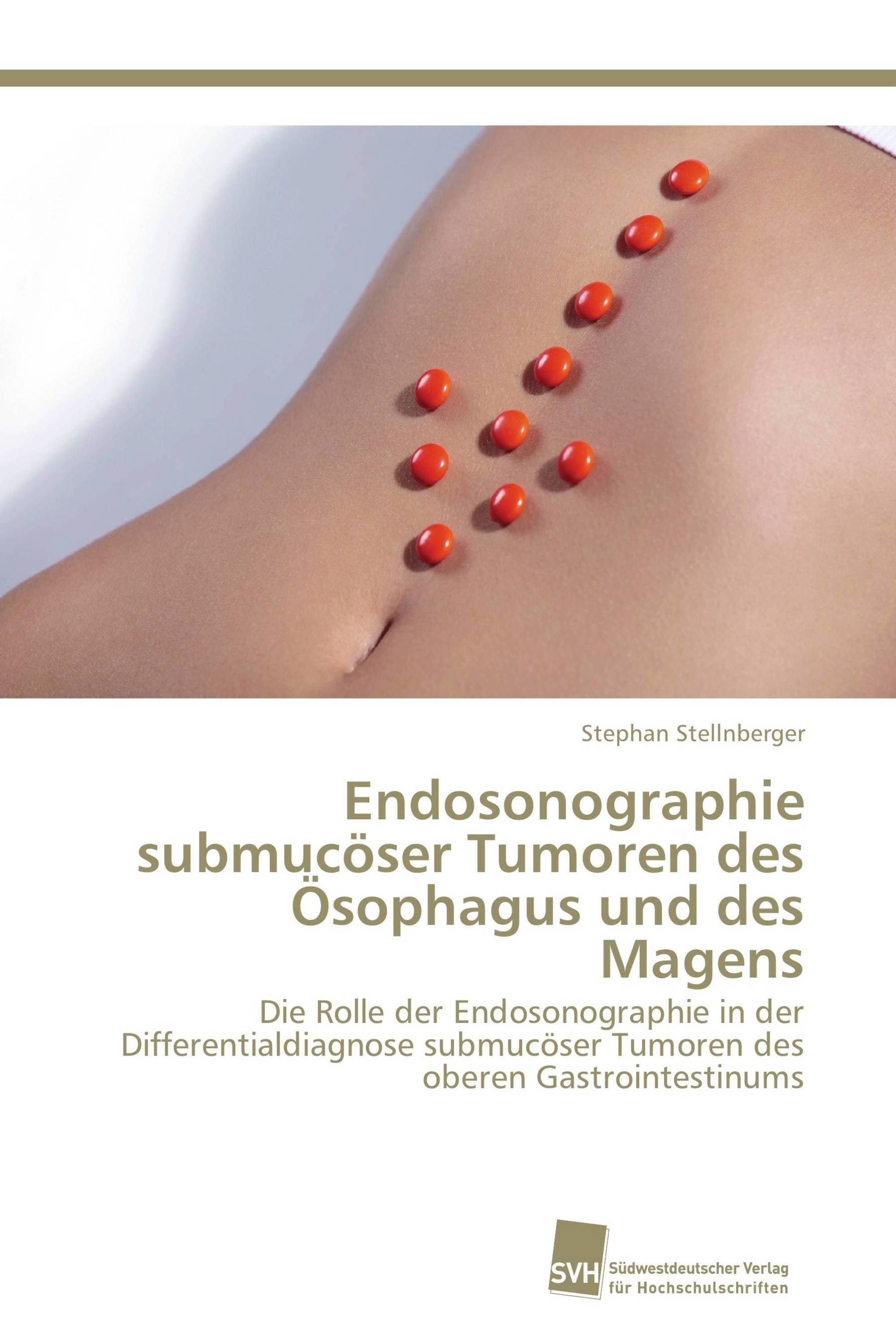 Endosonographie submucöser Tumoren des Ösophagus und des Magens