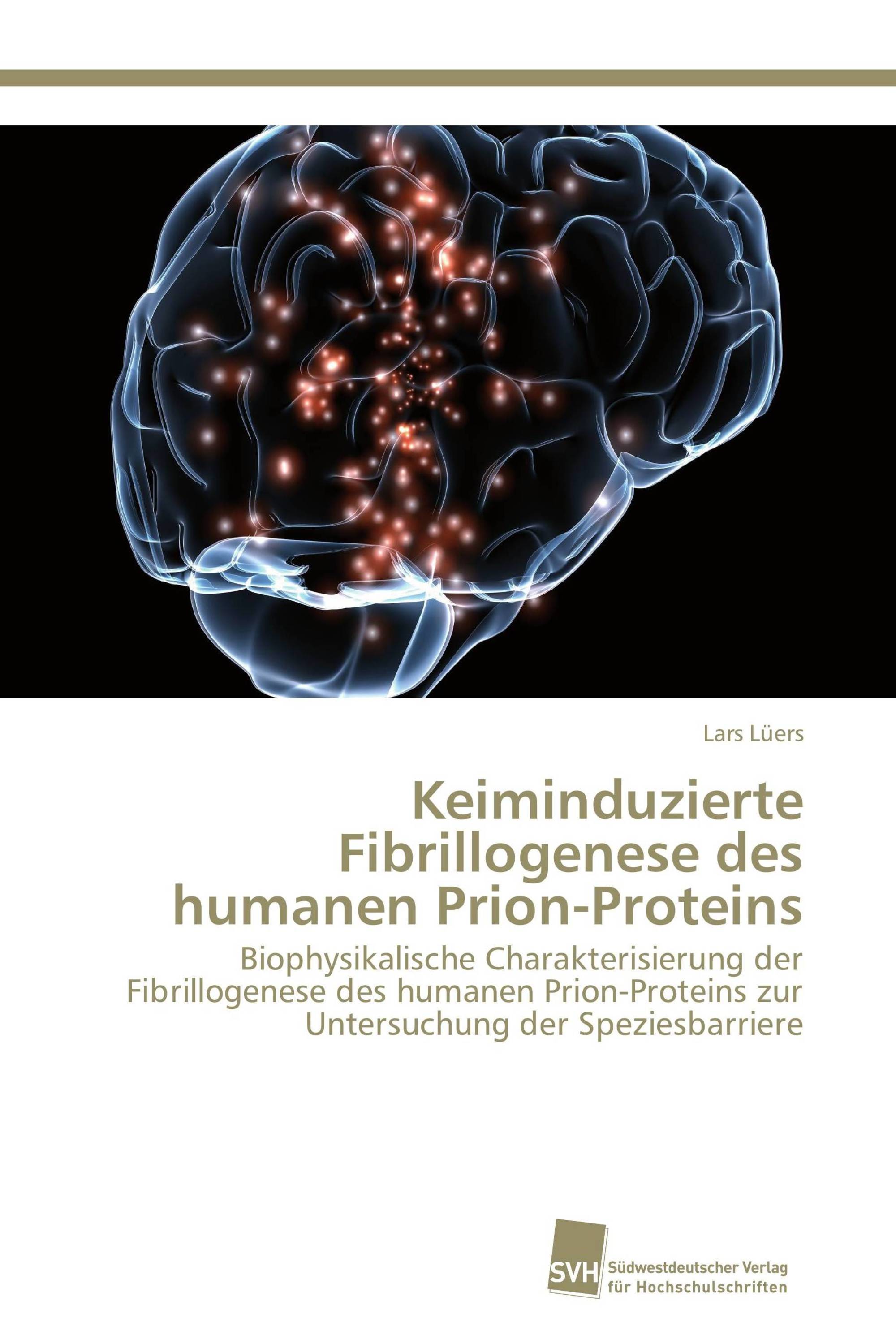 Keiminduzierte Fibrillogenese des humanen Prion-Proteins