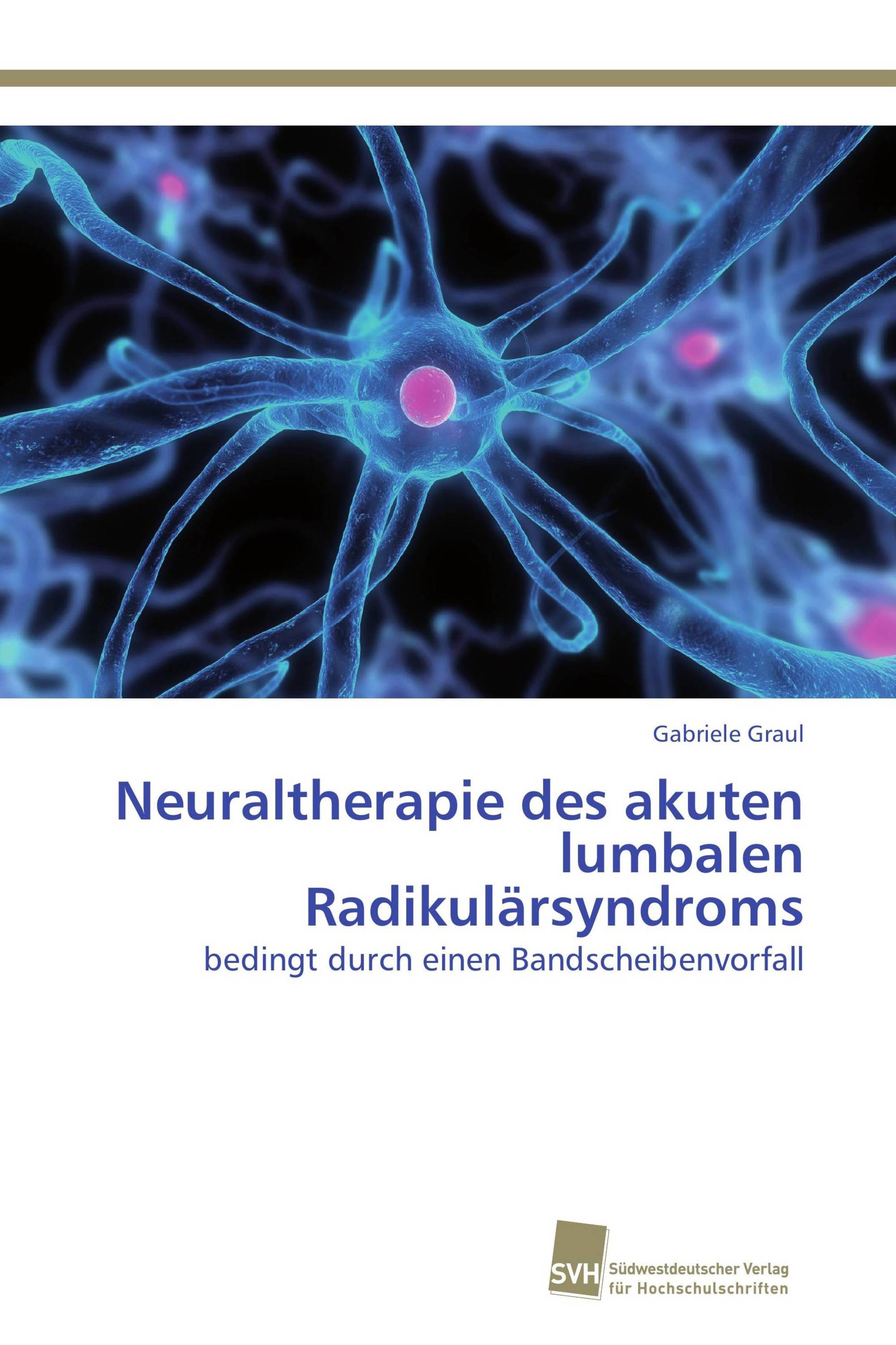 Neuraltherapie des akuten lumbalen Radikulärsyndroms