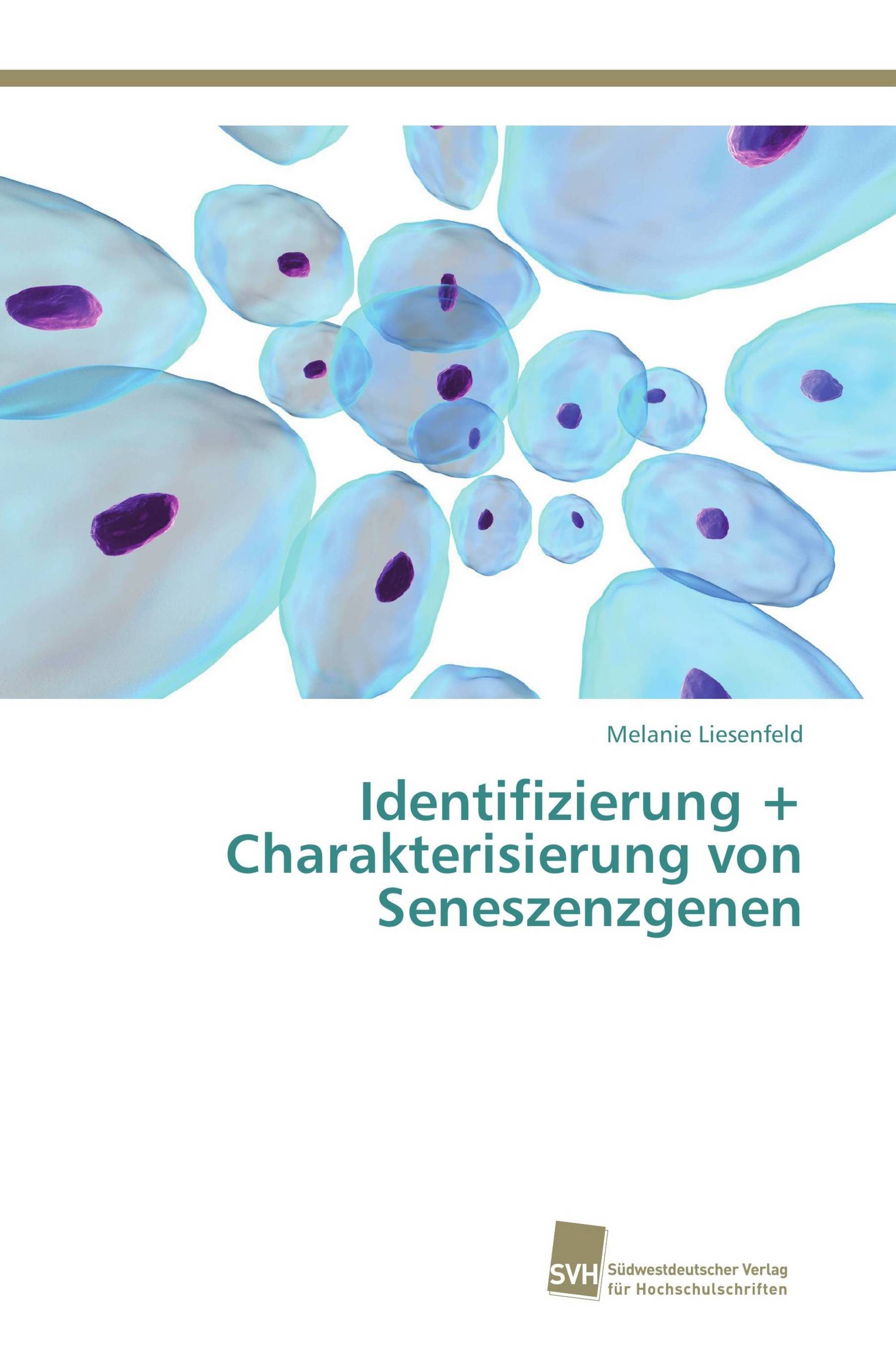 Identifizierung + Charakterisierung von Seneszenzgenen