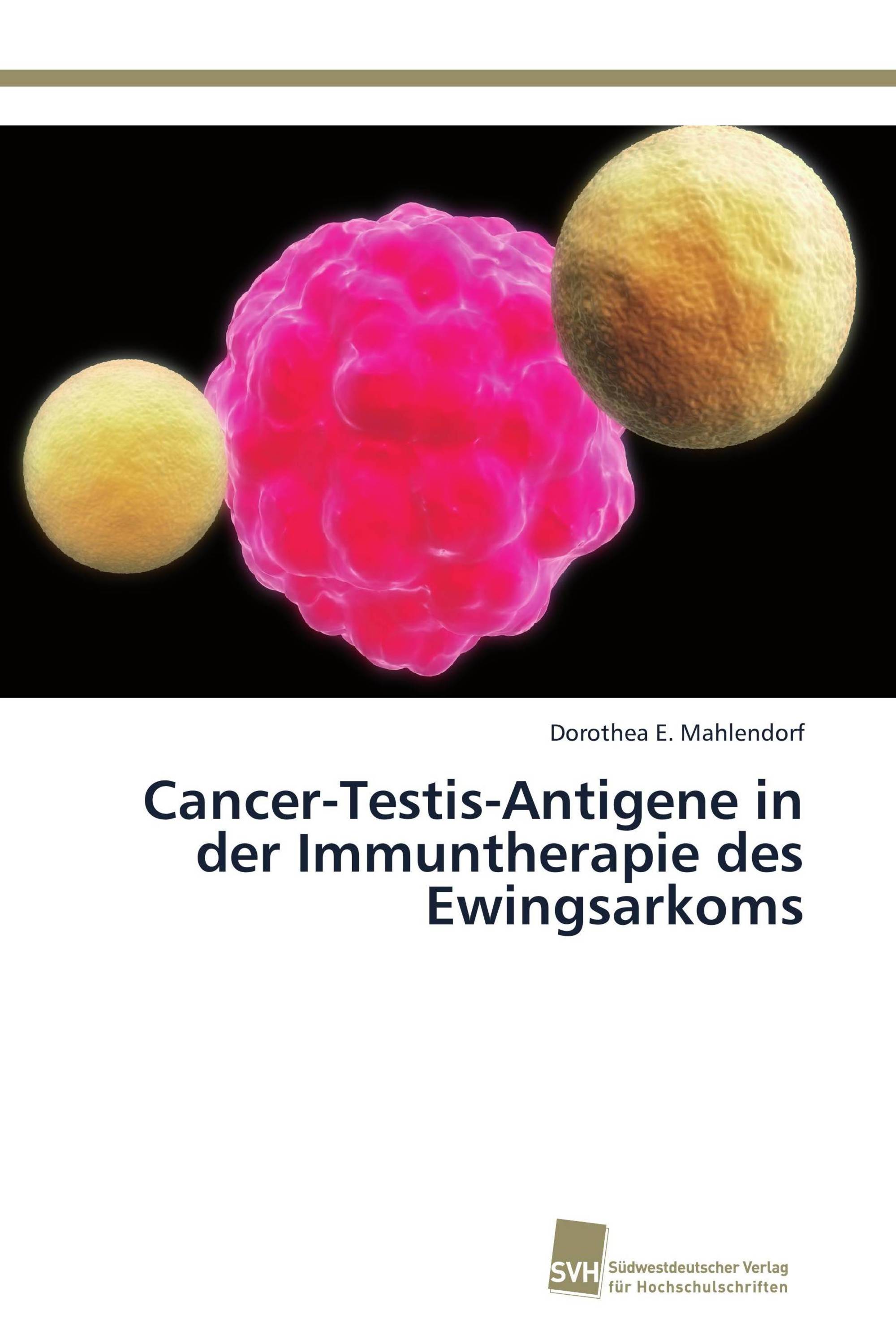 Cancer-Testis-Antigene in der Immuntherapie des Ewingsarkoms