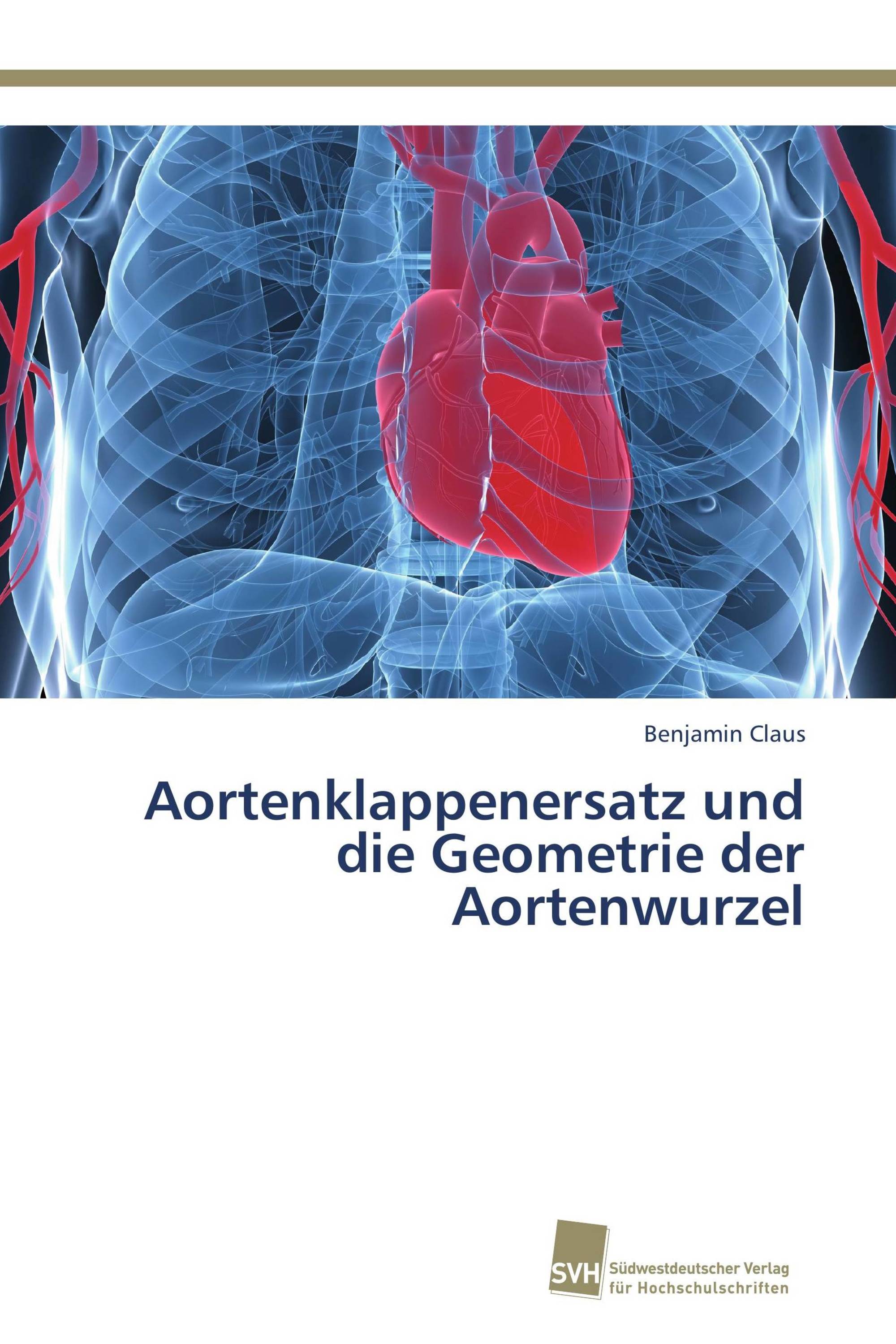 Aortenklappenersatz und die Geometrie der Aortenwurzel