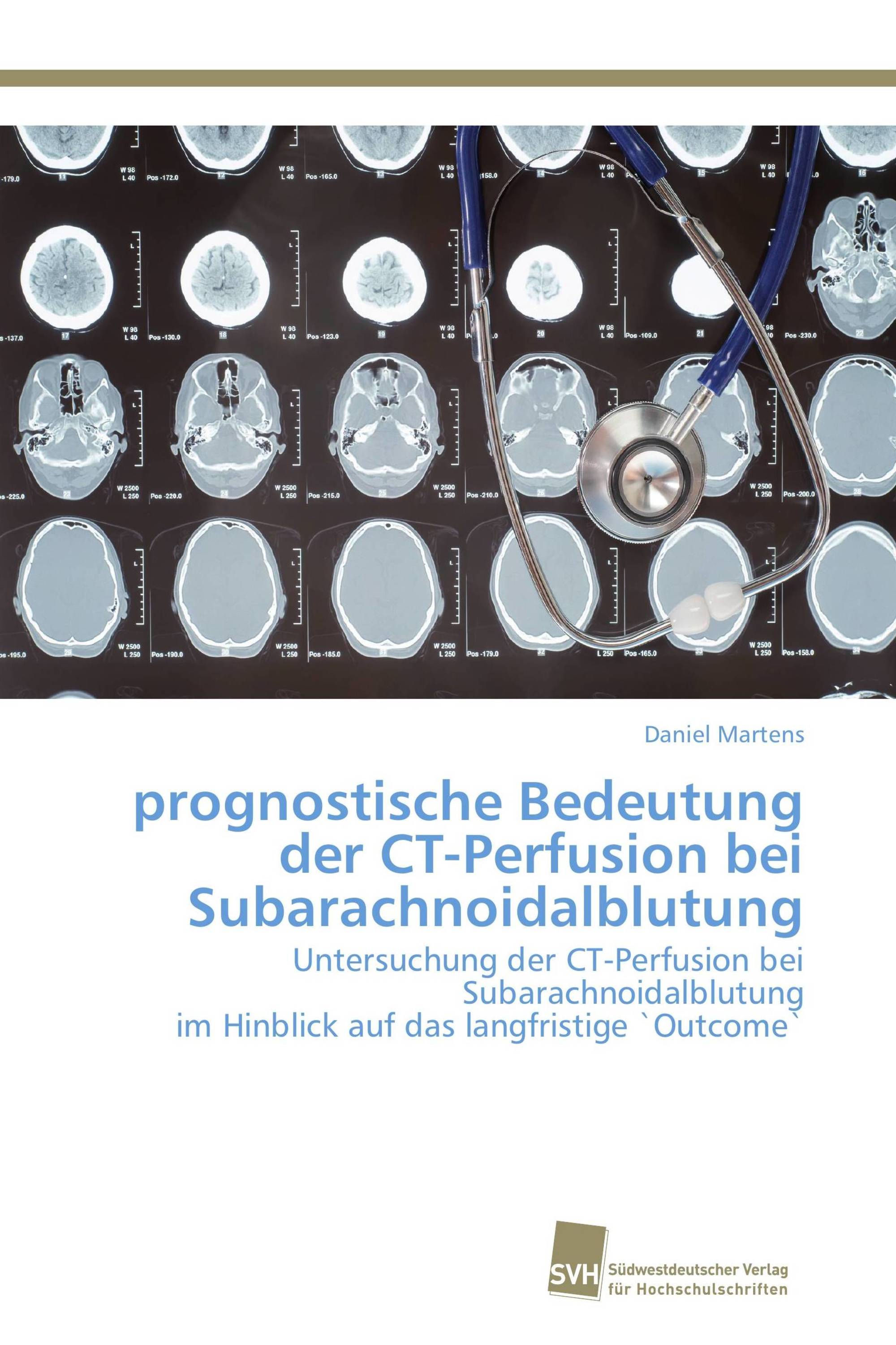 prognostische Bedeutung der CT-Perfusion bei Subarachnoidalblutung