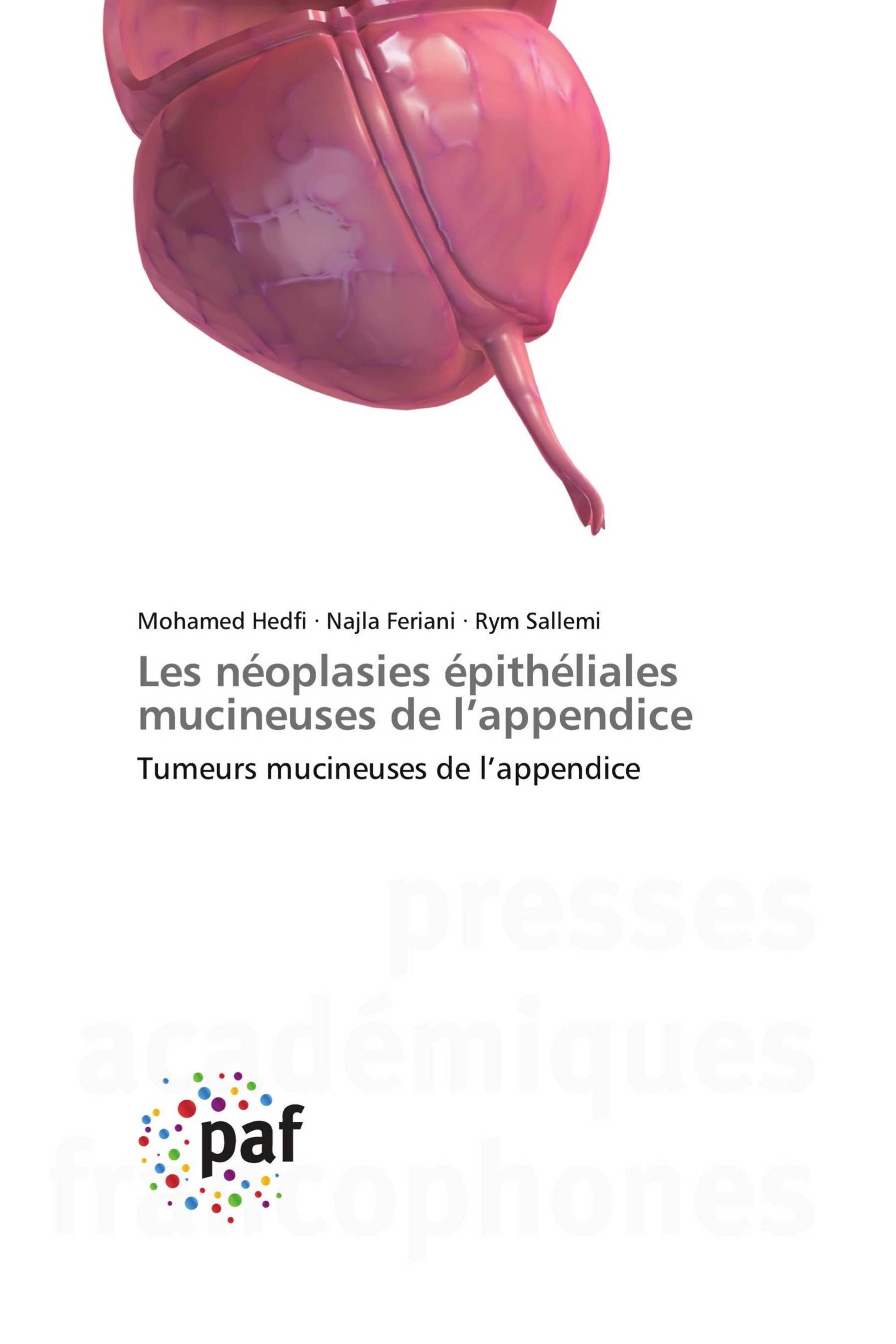 Les néoplasies épithéliales mucineuses de l’appendice