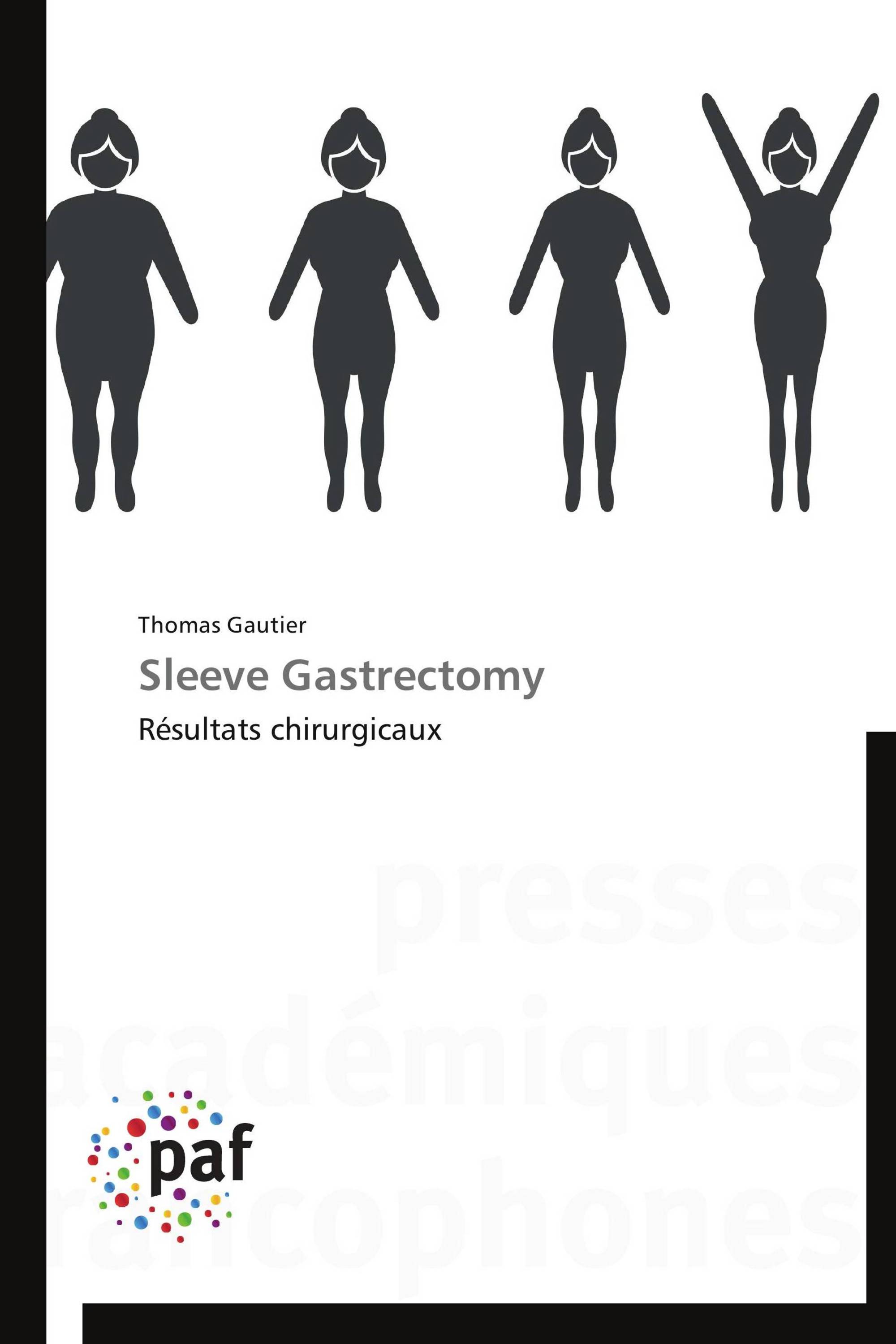 Sleeve Gastrectomy