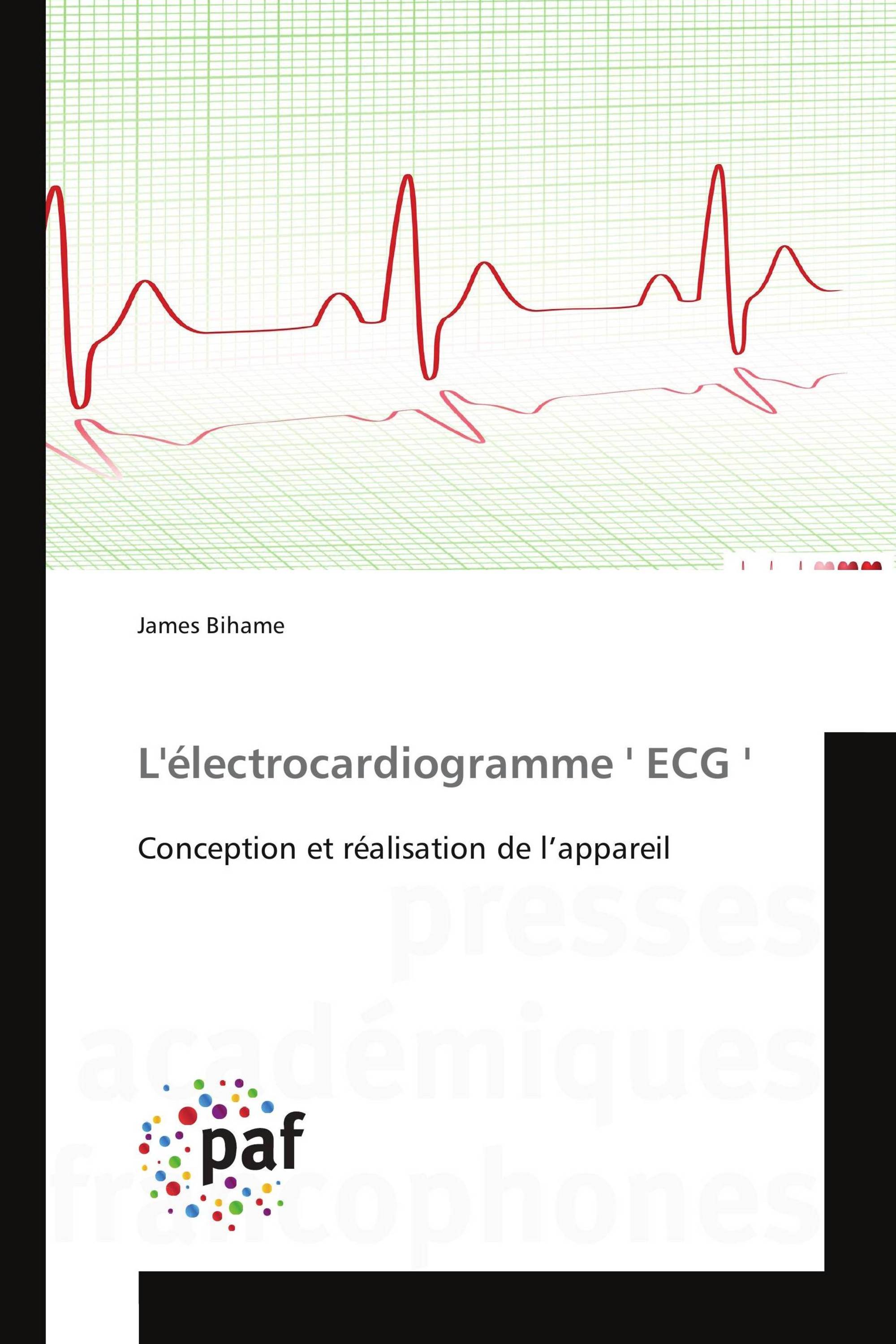 L'électrocardiogramme ' ECG '