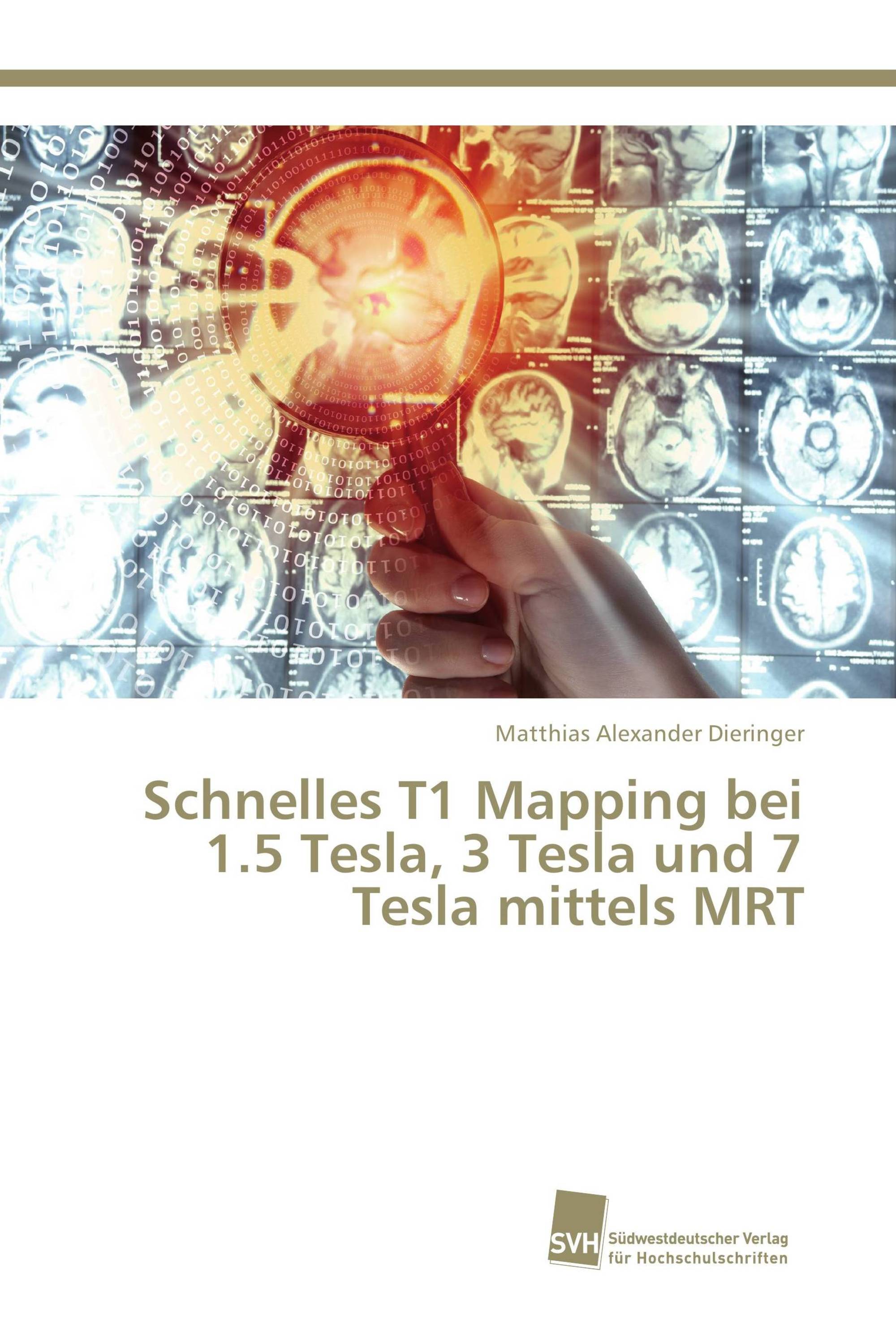 Schnelles T1 Mapping bei 1.5 Tesla, 3 Tesla und 7 Tesla mittels MRT