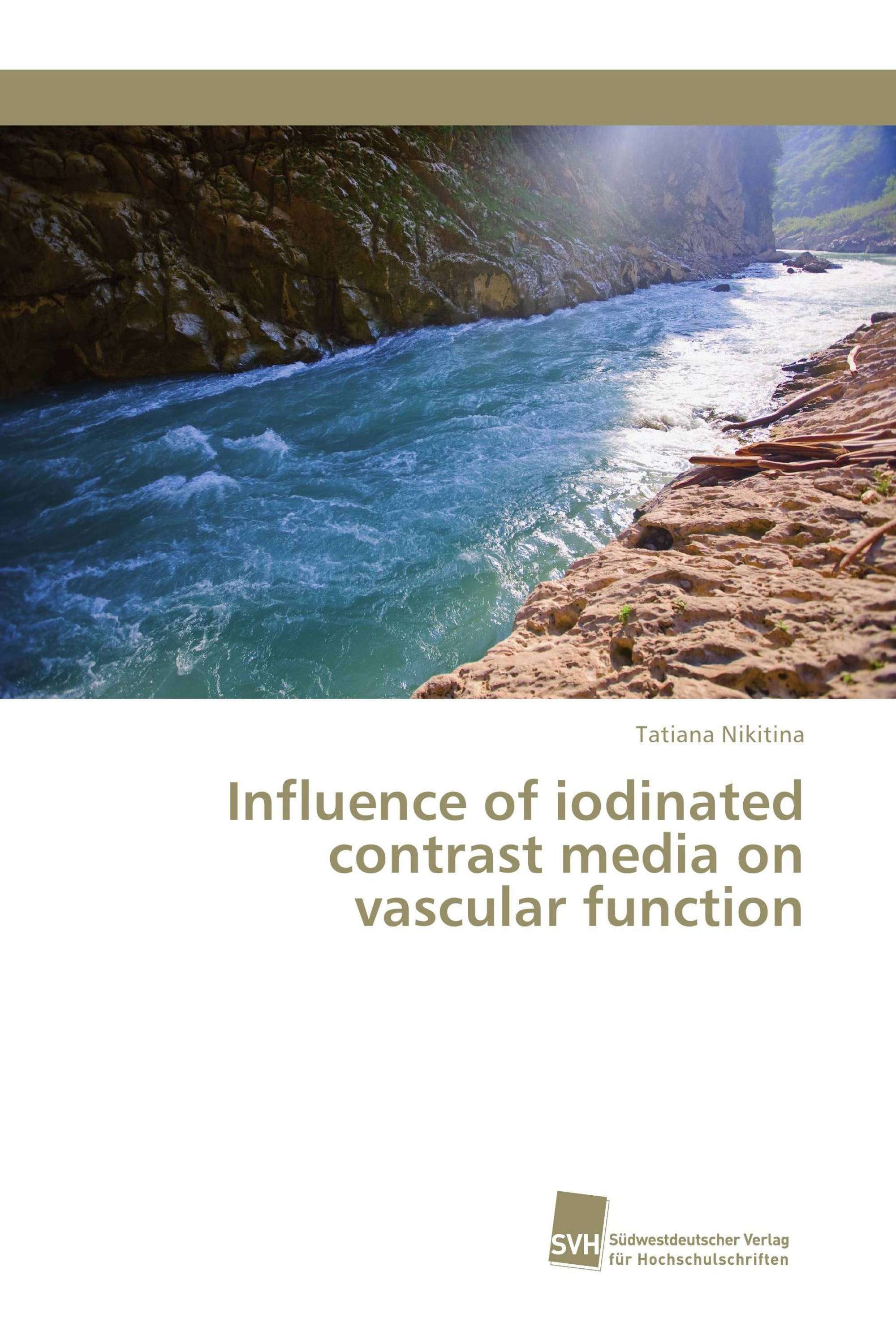 Influence of iodinated contrast media on vascular function