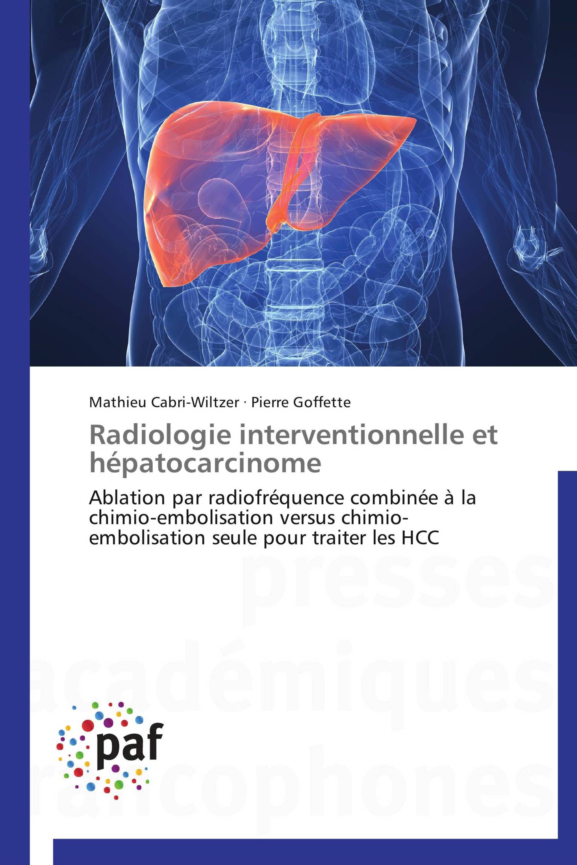 Radiologie interventionnelle et hépatocarcinome