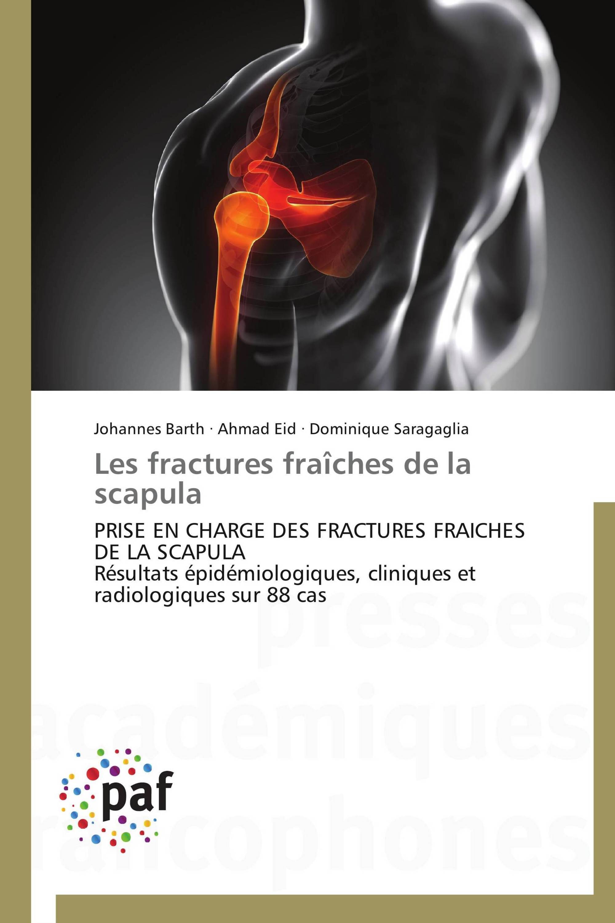 Les fractures fraîches de la scapula