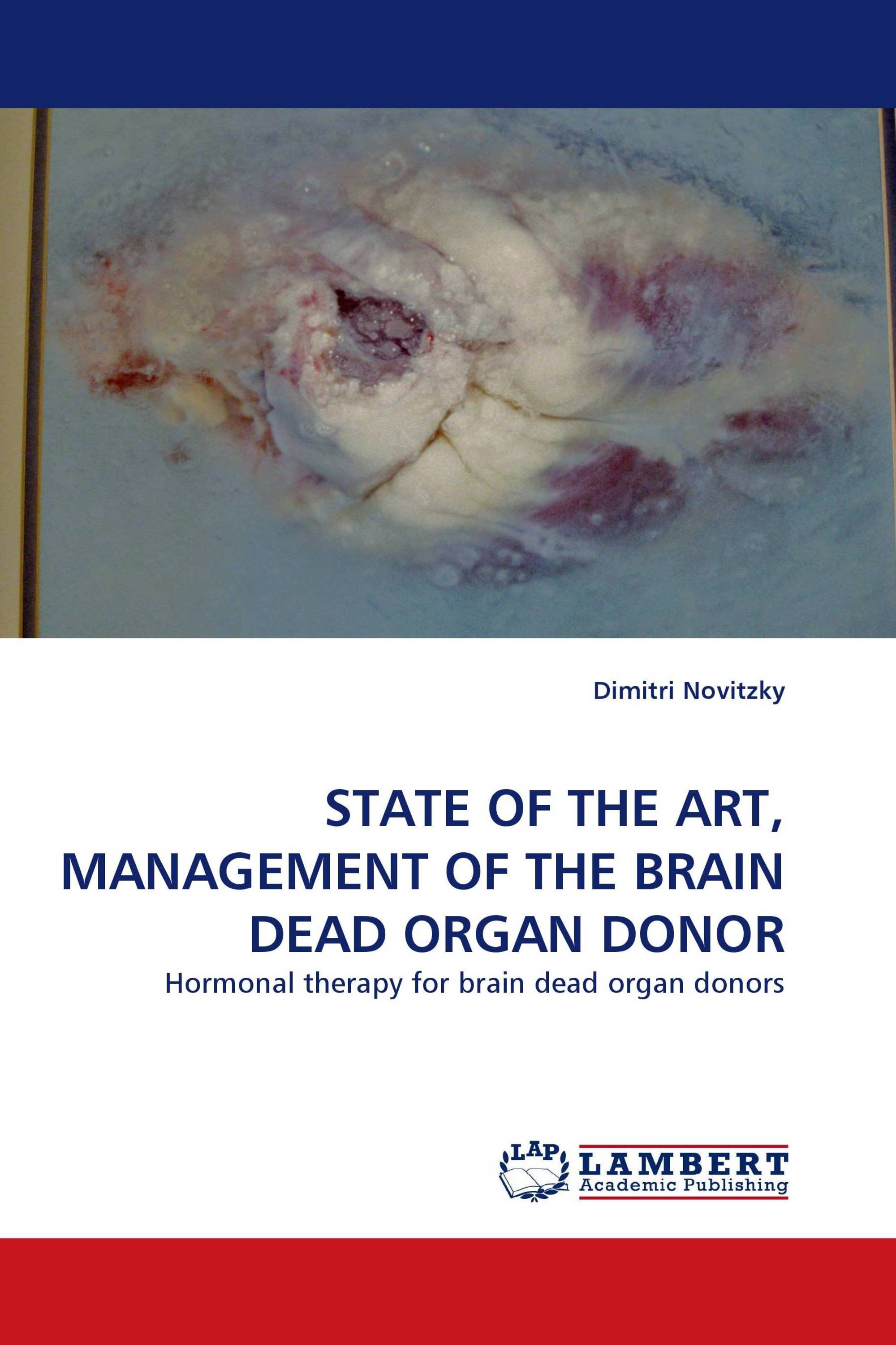 STATE OF THE ART, MANAGEMENT OF THE BRAIN DEAD ORGAN DONOR