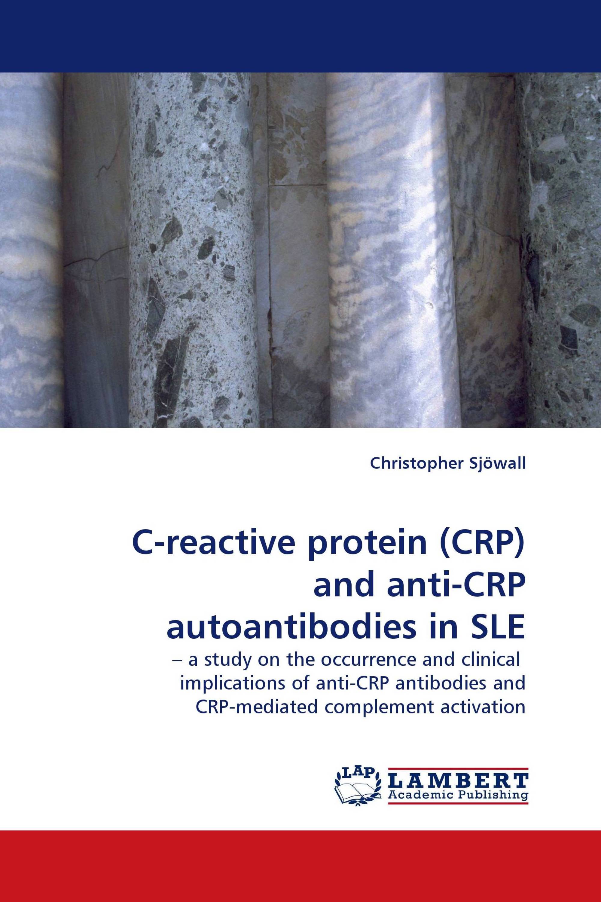 C-reactive protein (CRP) and anti-CRP autoantibodies in SLE