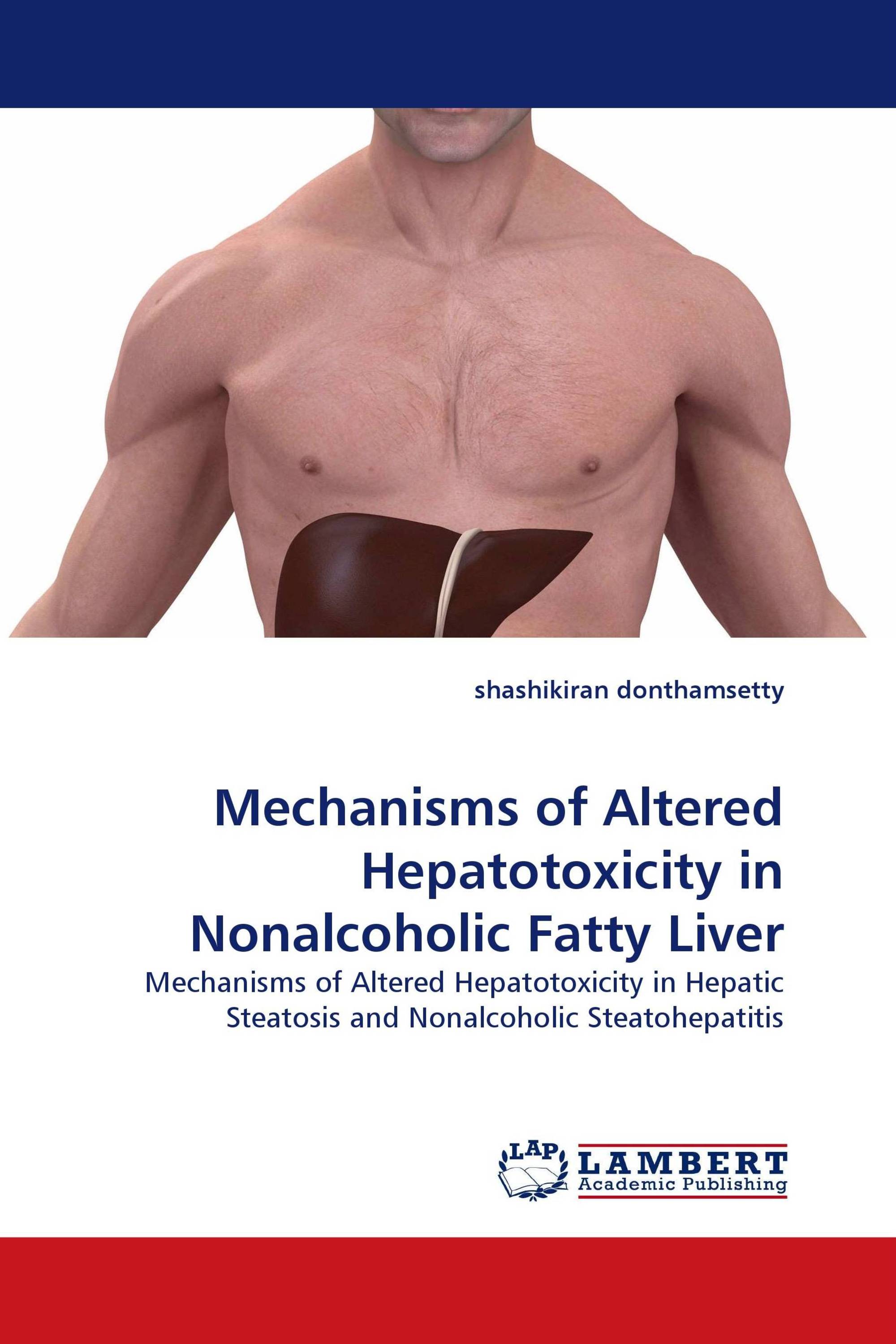 Mechanisms of Altered Hepatotoxicity in Nonalcoholic Fatty Liver