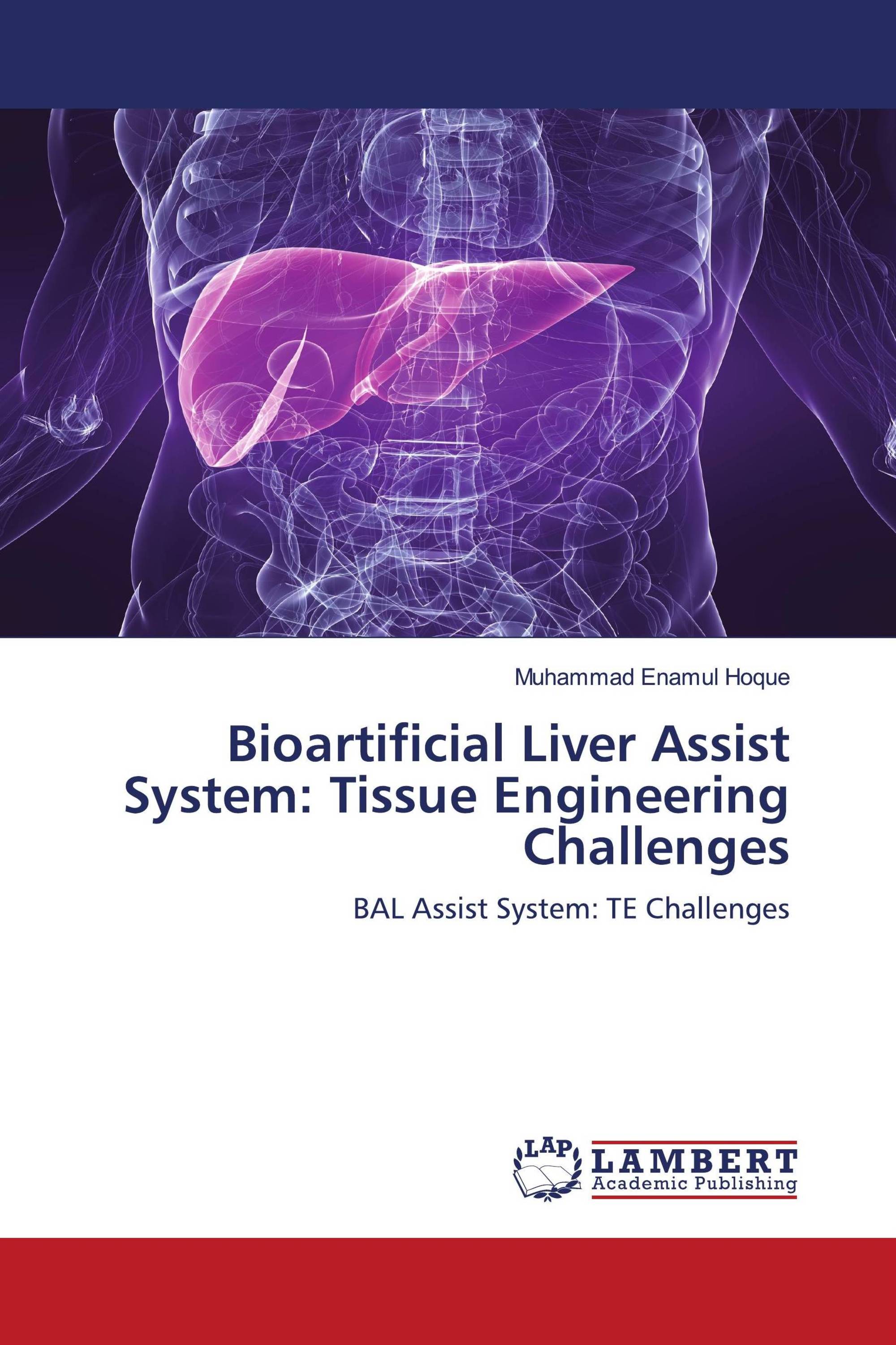 Bioartificial Liver Assist System: Tissue Engineering Challenges