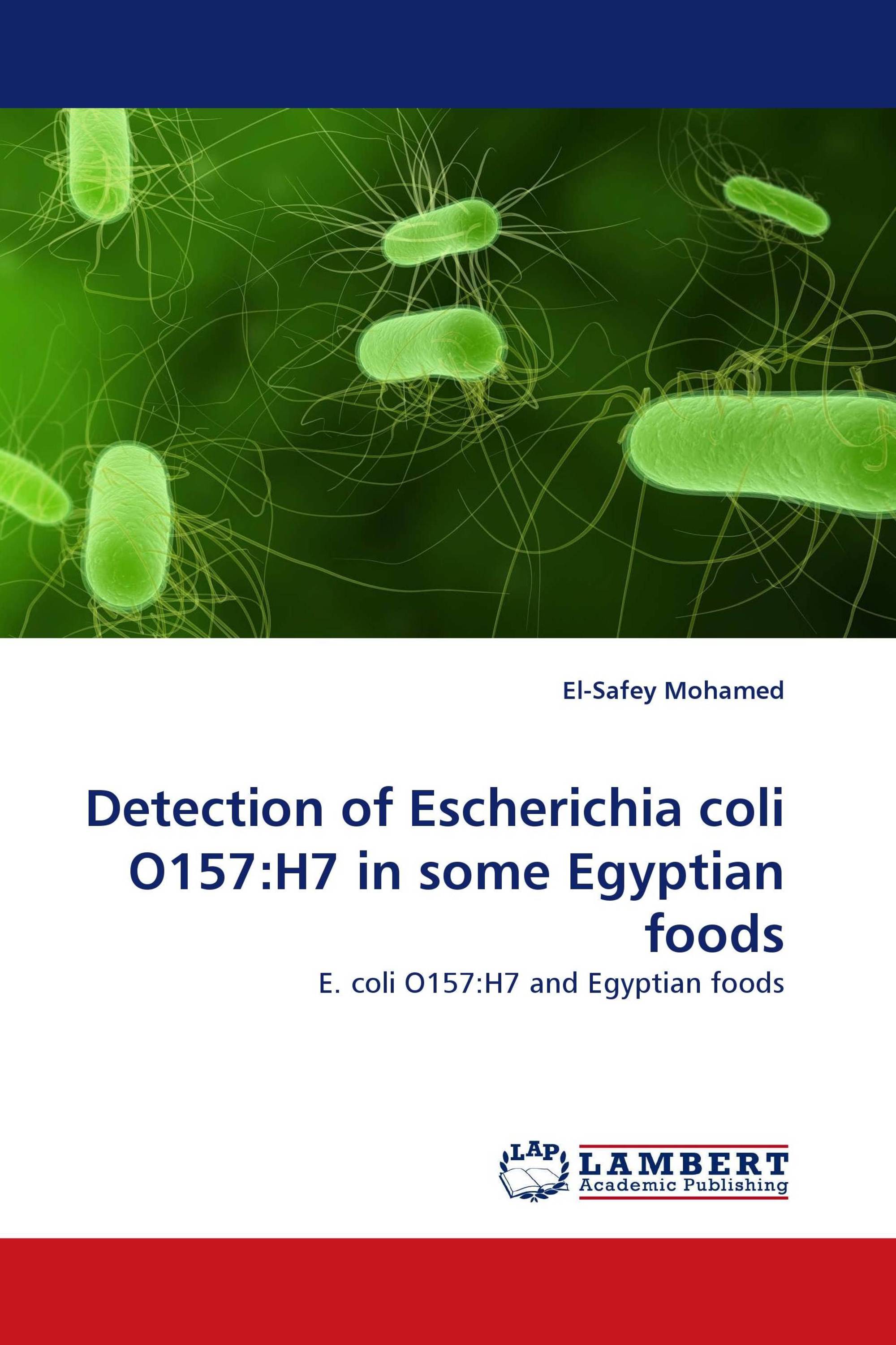 Detection of Escherichia coli O157:H7 in some Egyptian foods