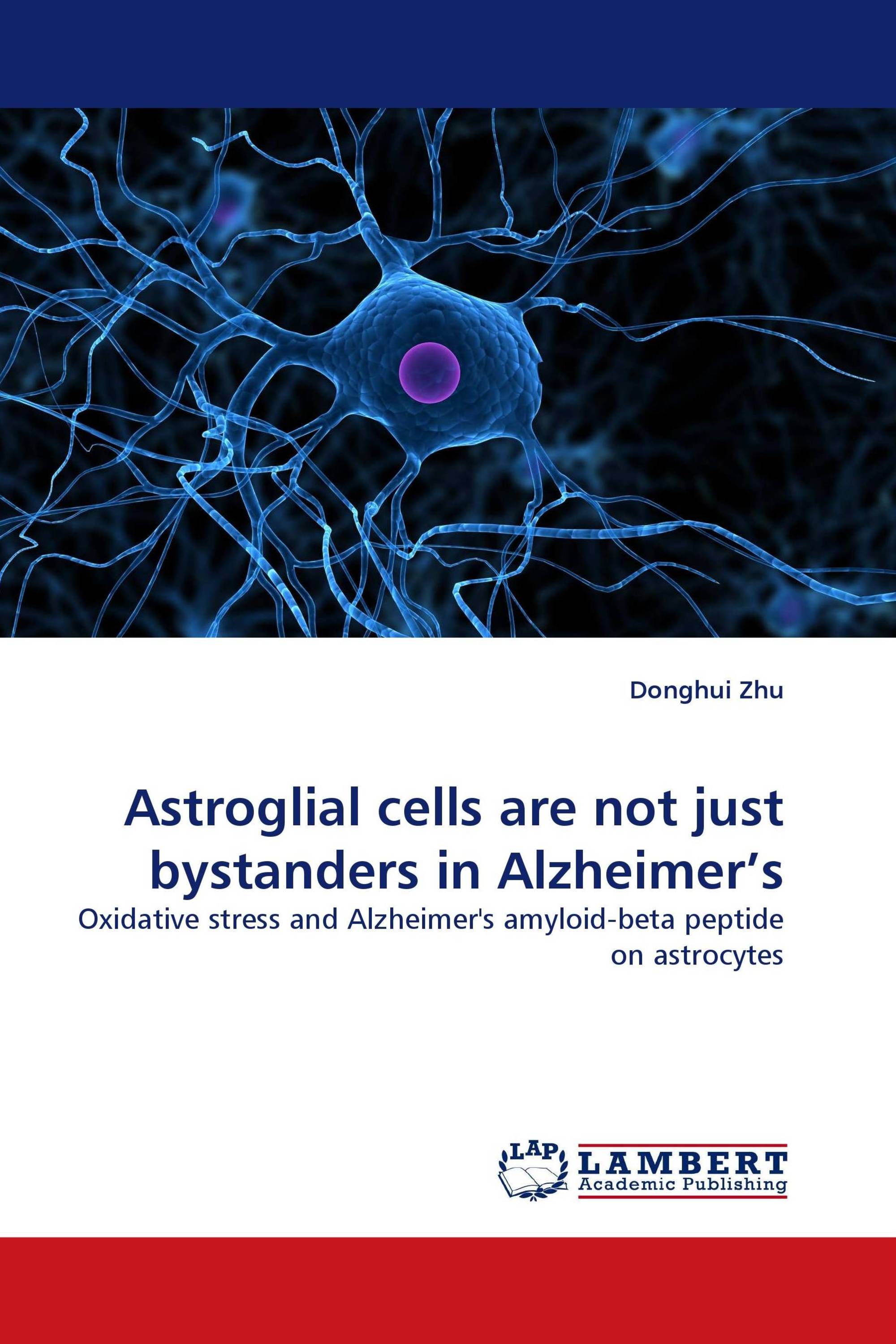 Astroglial cells are not just bystanders in Alzheimer''s