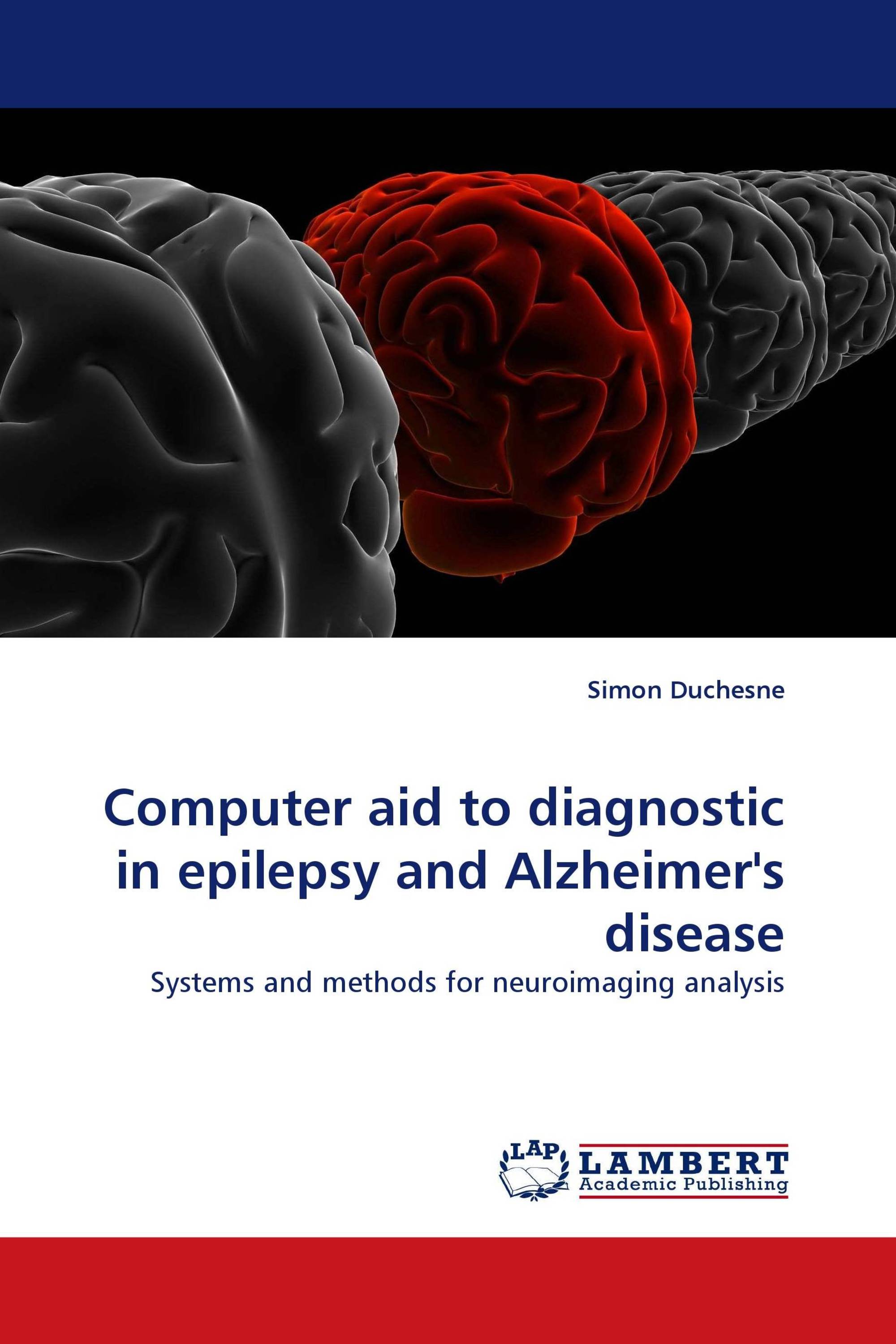 Computer aid to diagnostic in  epilepsy and  Alzheimer''s disease