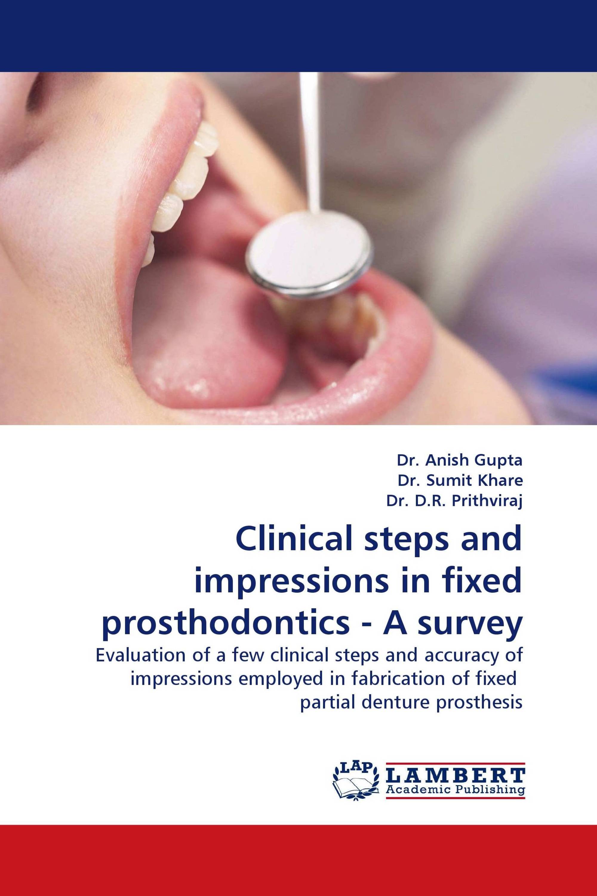 Clinical steps and impressions in fixed prosthodontics - A survey