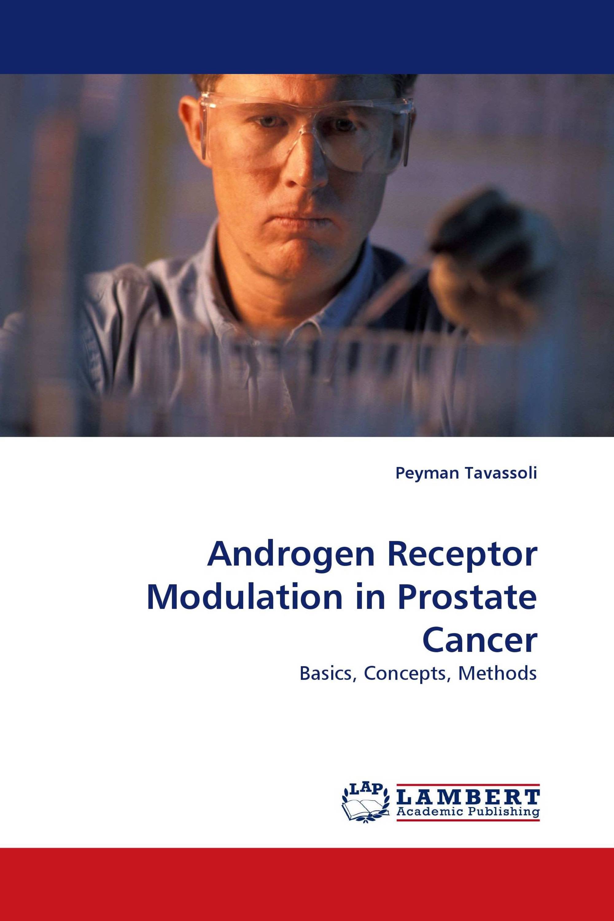 Androgen Receptor Modulation in Prostate Cancer