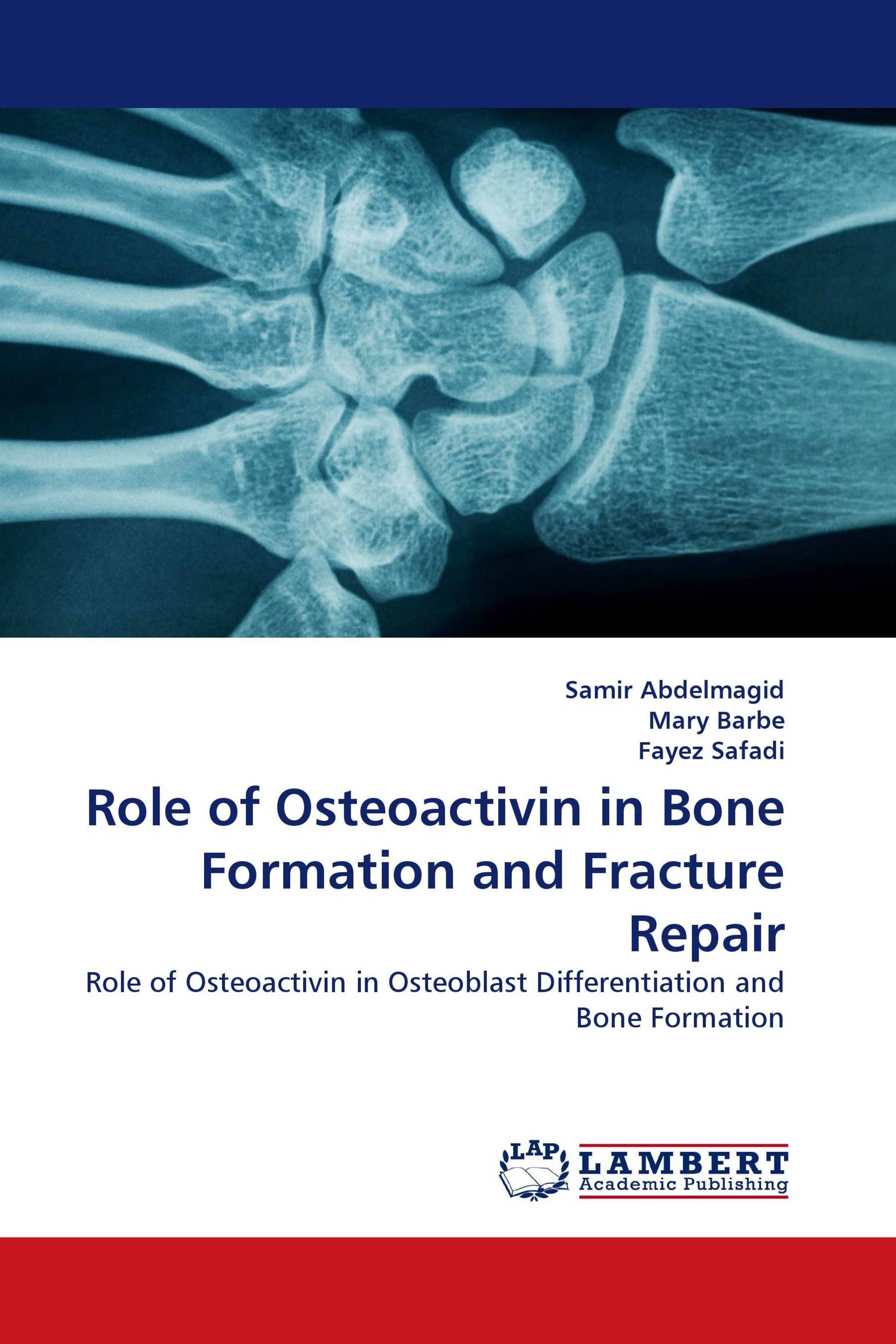 Role of Osteoactivin in Bone Formation and Fracture Repair