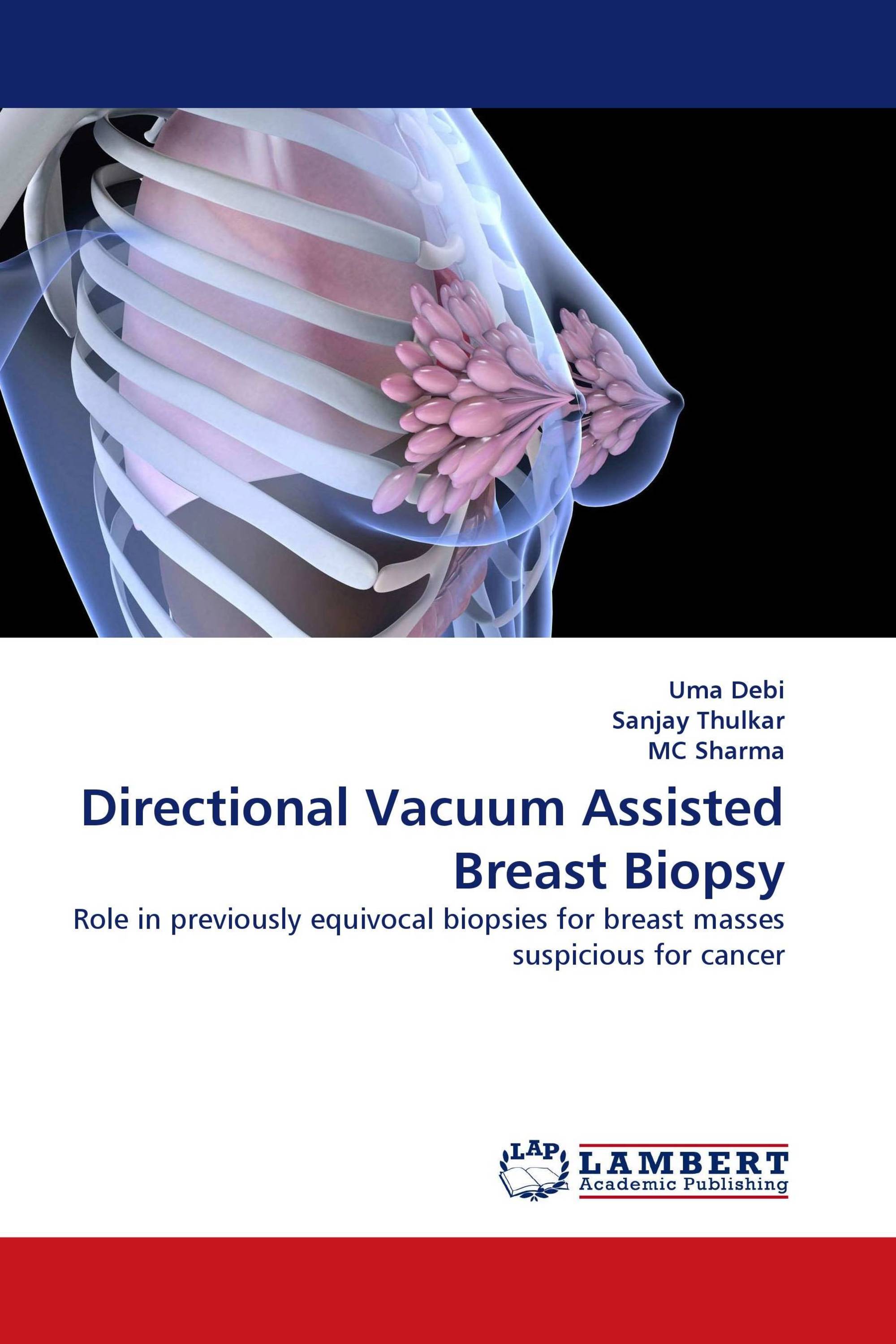 Directional Vacuum Assisted Breast Biopsy