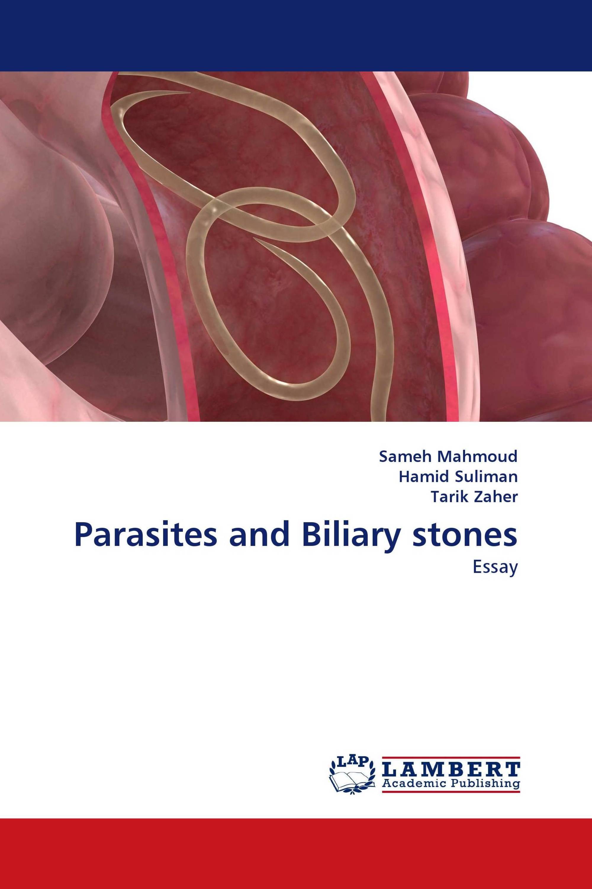 Parasites and Biliary stones