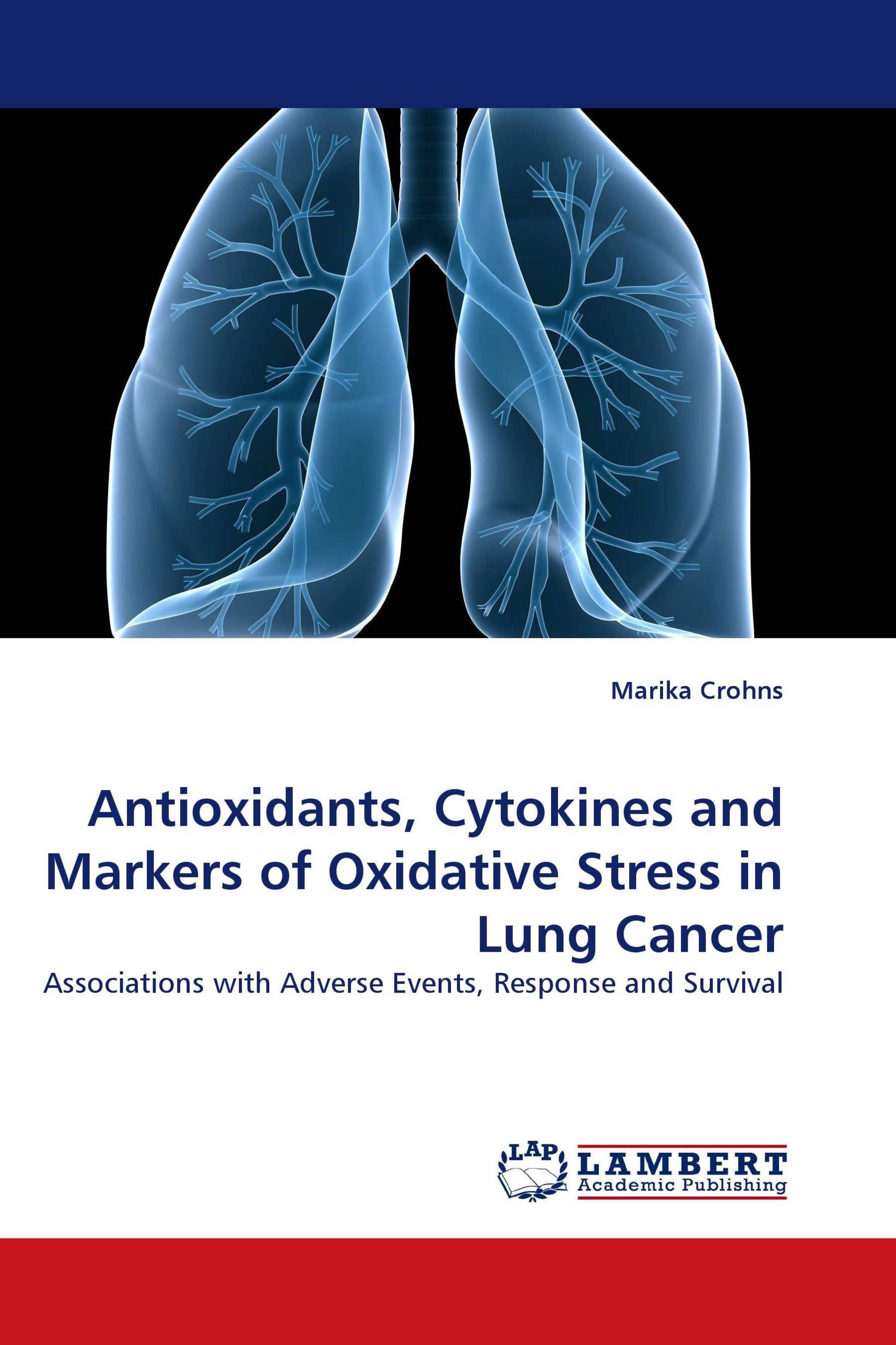 Antioxidants, Cytokines and Markers of Oxidative Stress in Lung Cancer