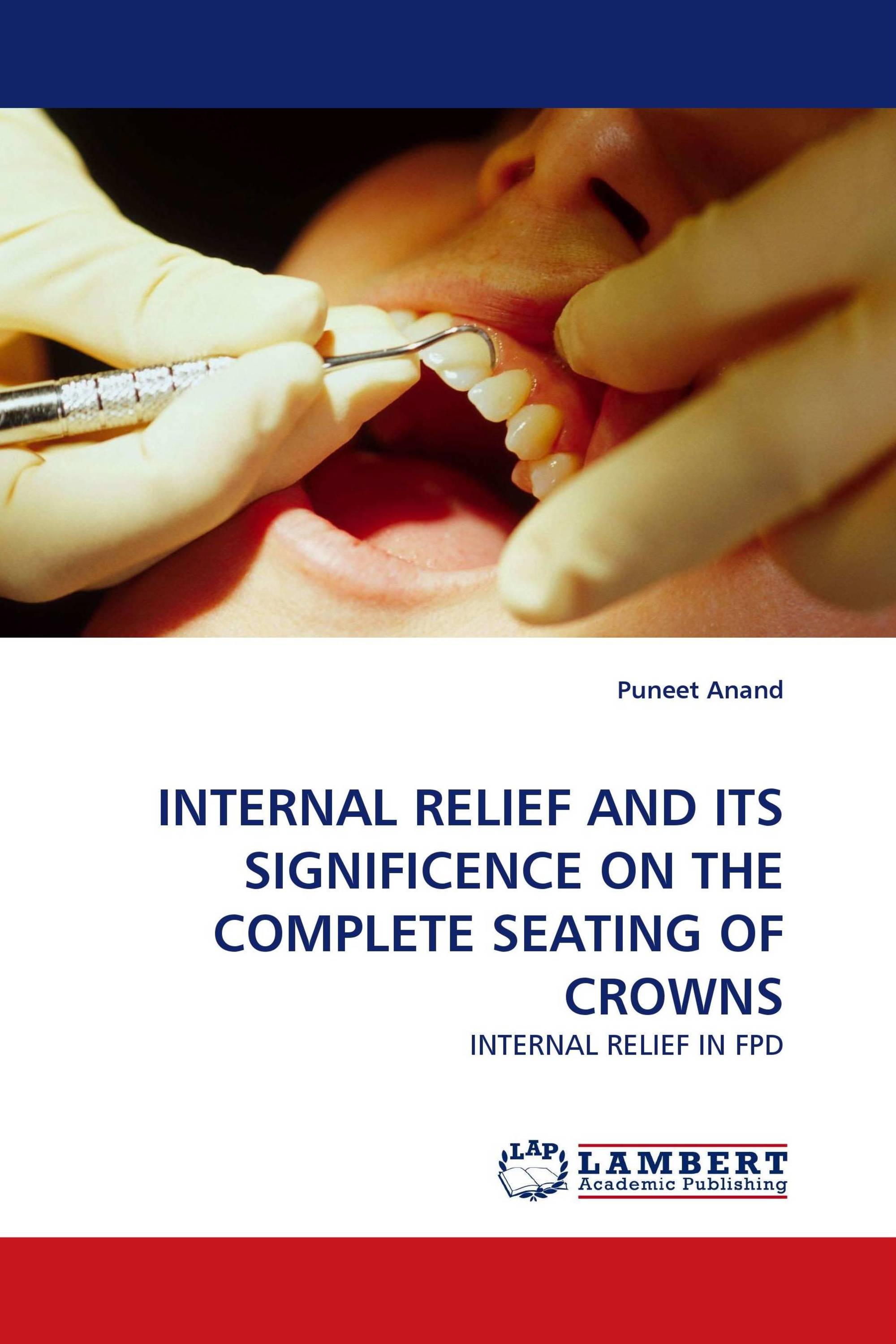 INTERNAL RELIEF AND ITS SIGNIFICENCE ON THE COMPLETE SEATING OF CROWNS