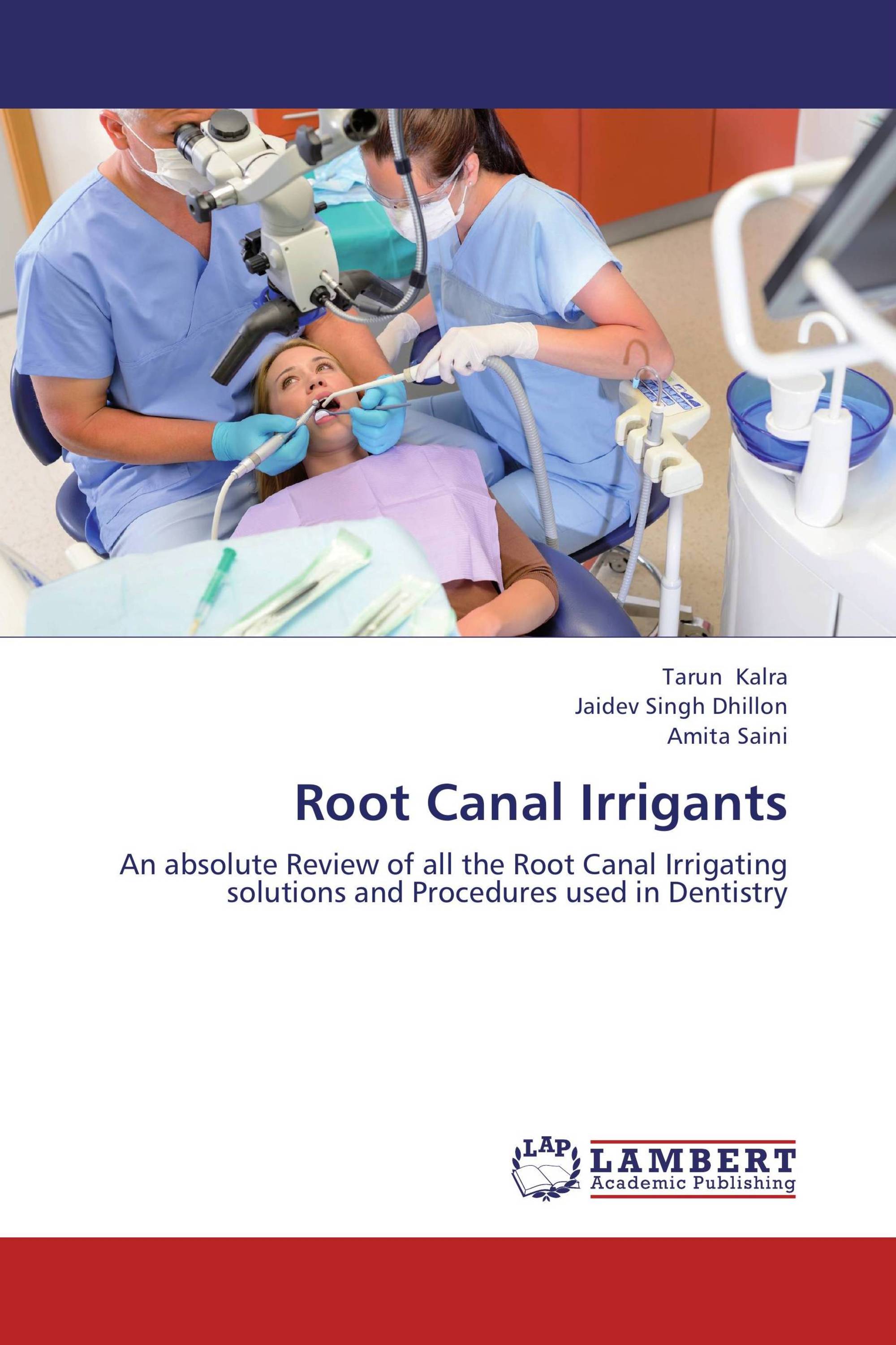 Root Canal Irrigants / 9783838381930 / 9783838381930 / 3838381939