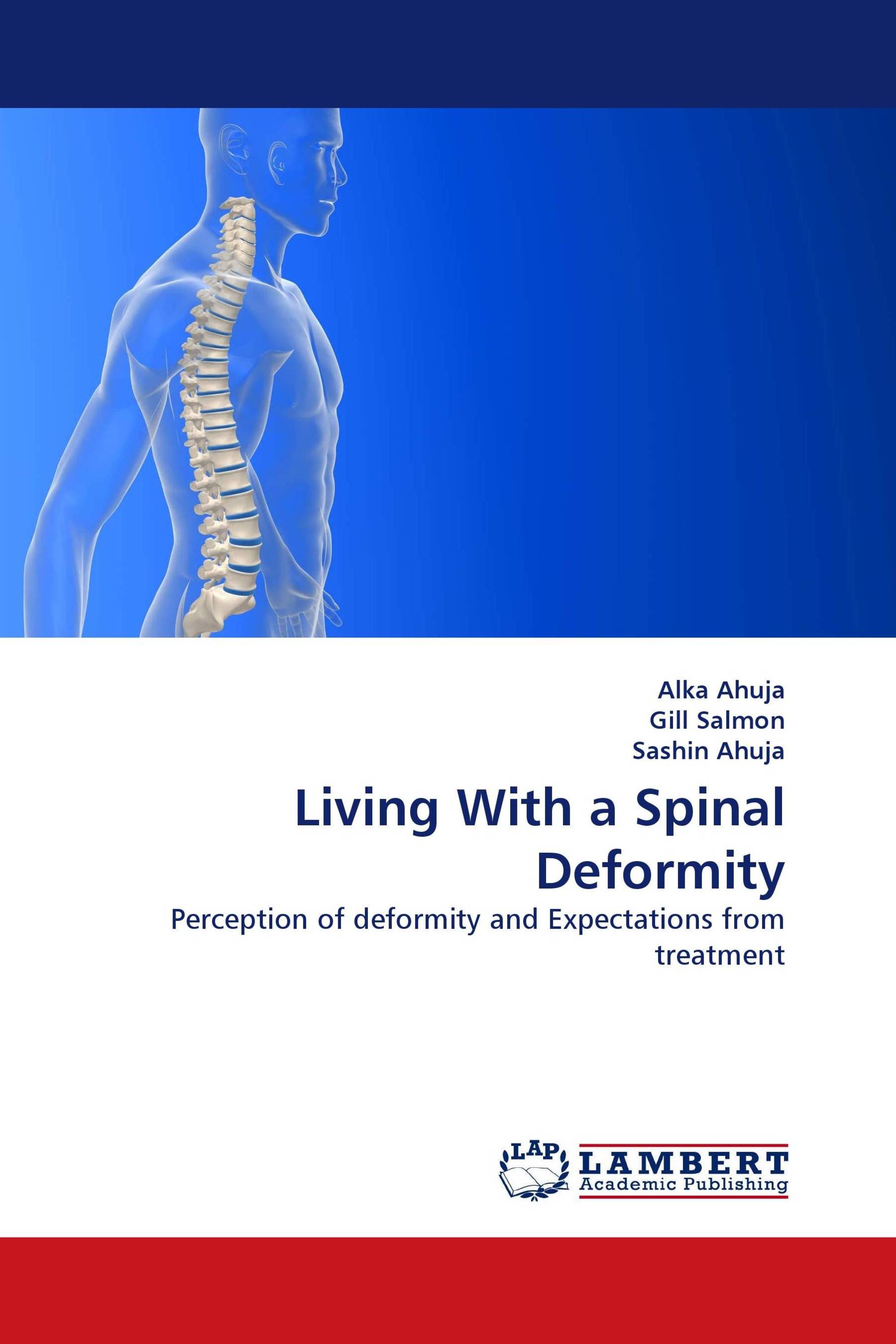 Living With a Spinal Deformity