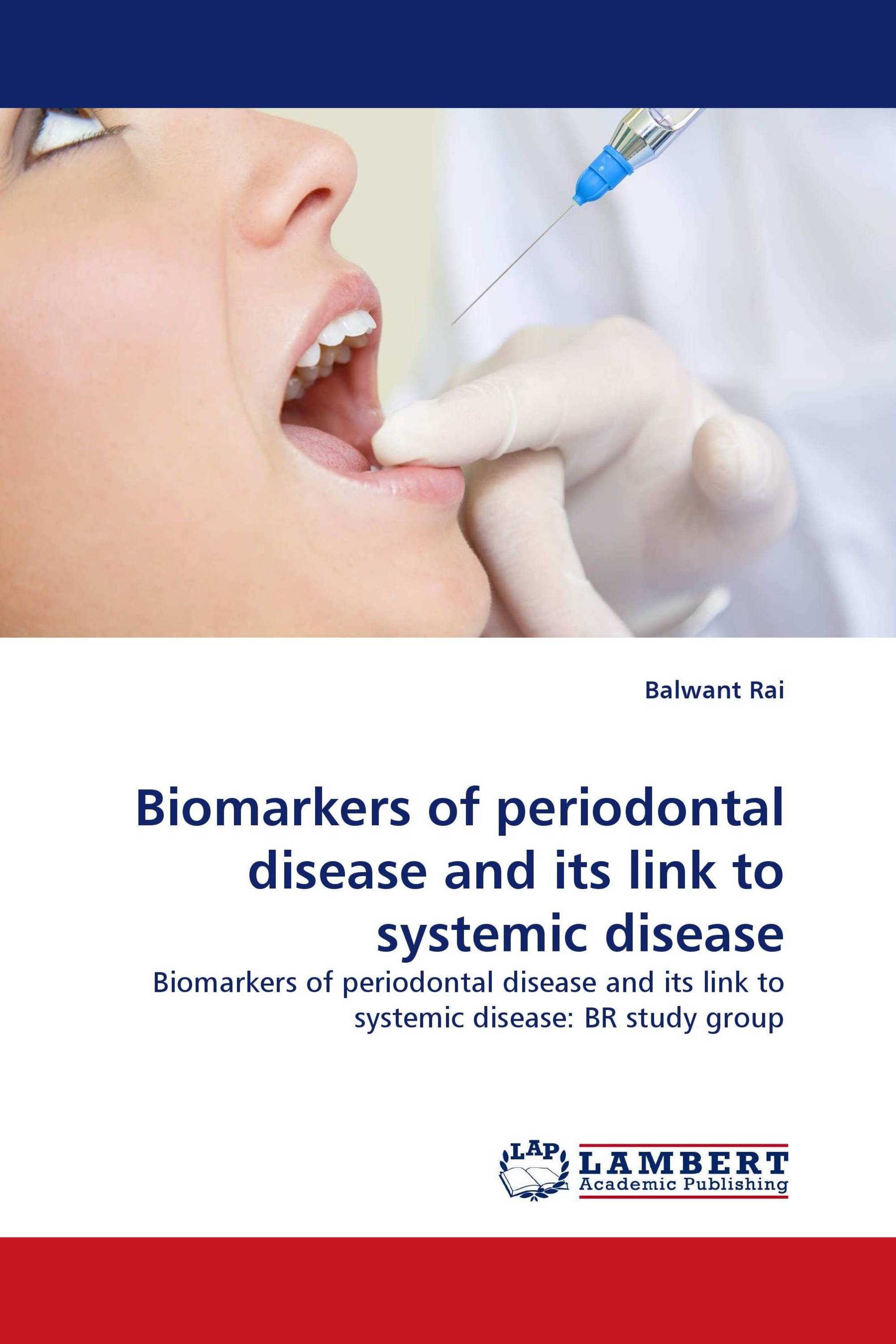Biomarkers of periodontal disease and its link to systemic disease