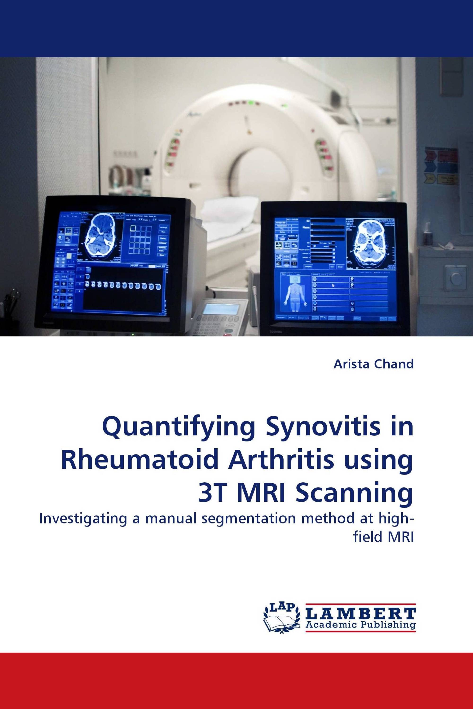 Quantifying Synovitis in Rheumatoid Arthritis using 3T MRI Scanning