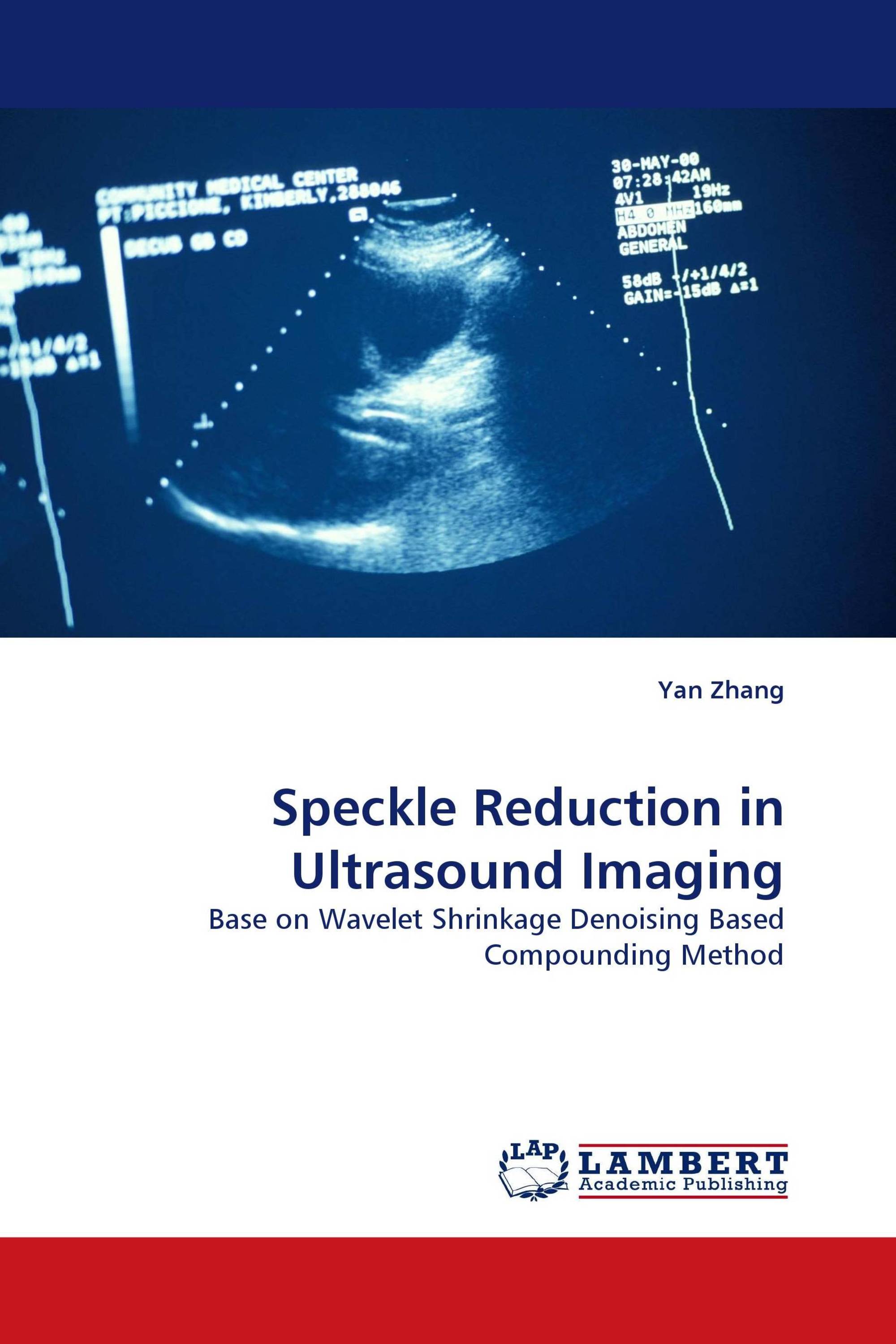 Speckle Reduction in Ultrasound Imaging