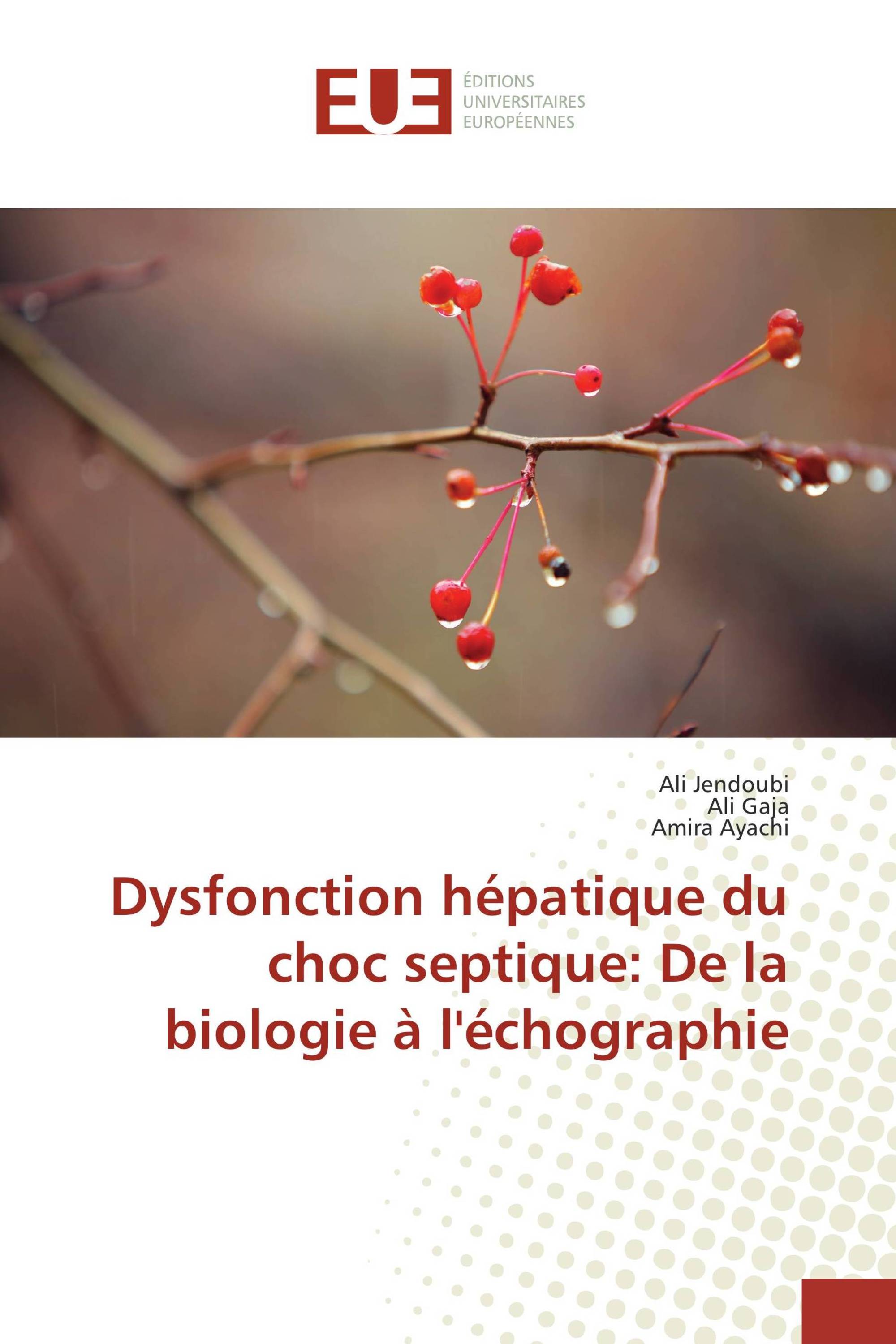 Dysfonction hépatique du choc septique: De la biologie à l'échographie