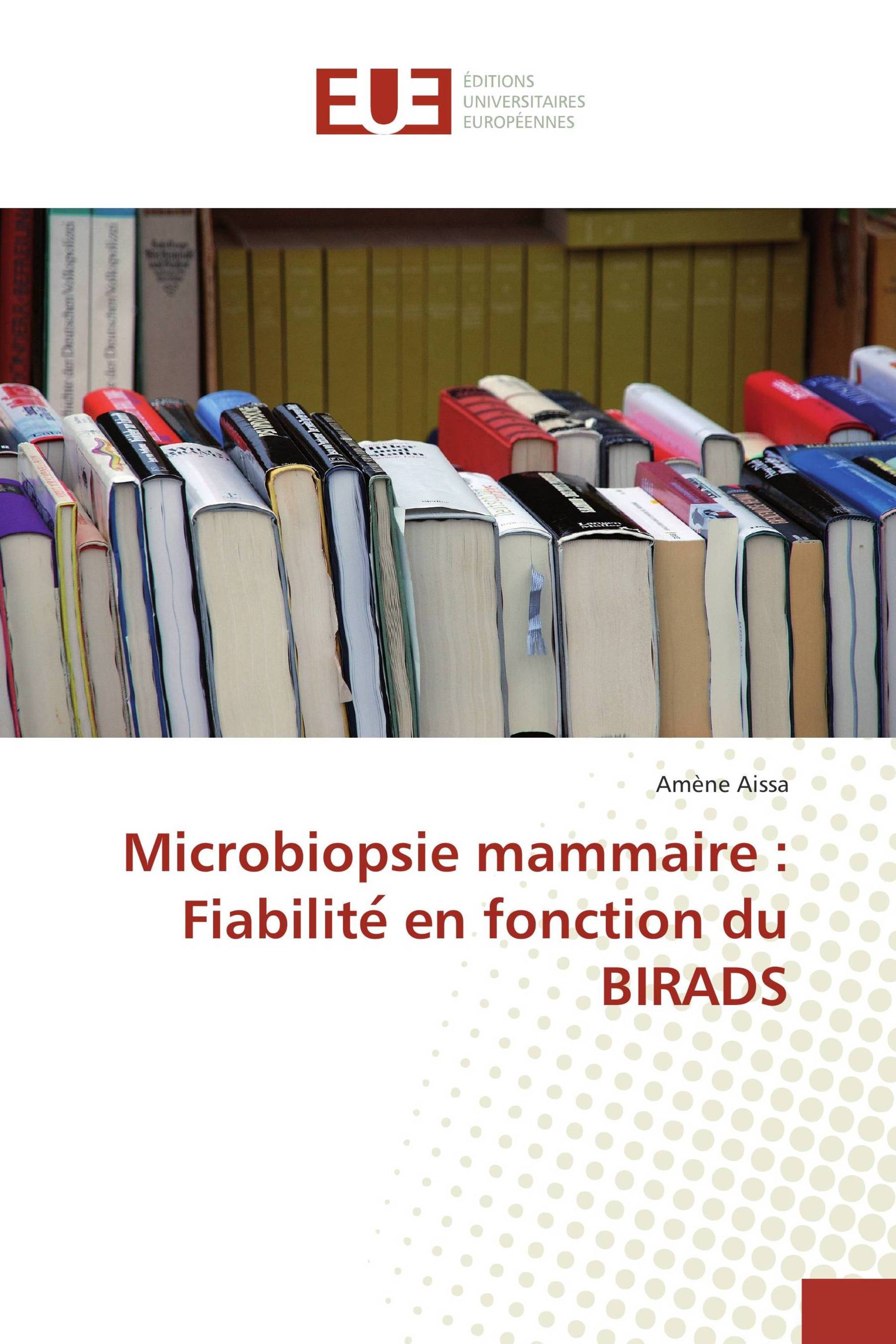 Microbiopsie mammaire : Fiabilité en fonction du BIRADS