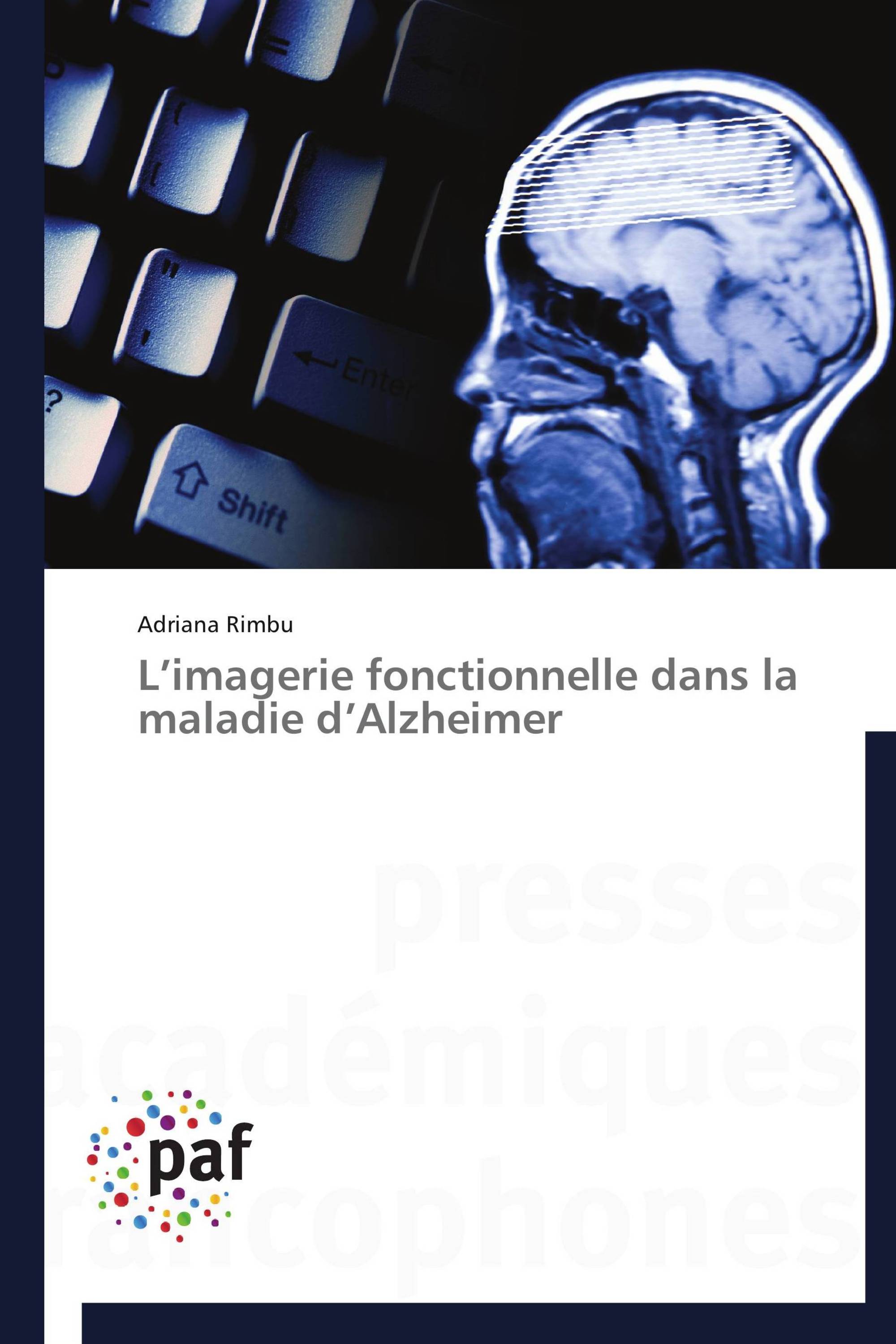 L’imagerie fonctionnelle dans la maladie d’Alzheimer