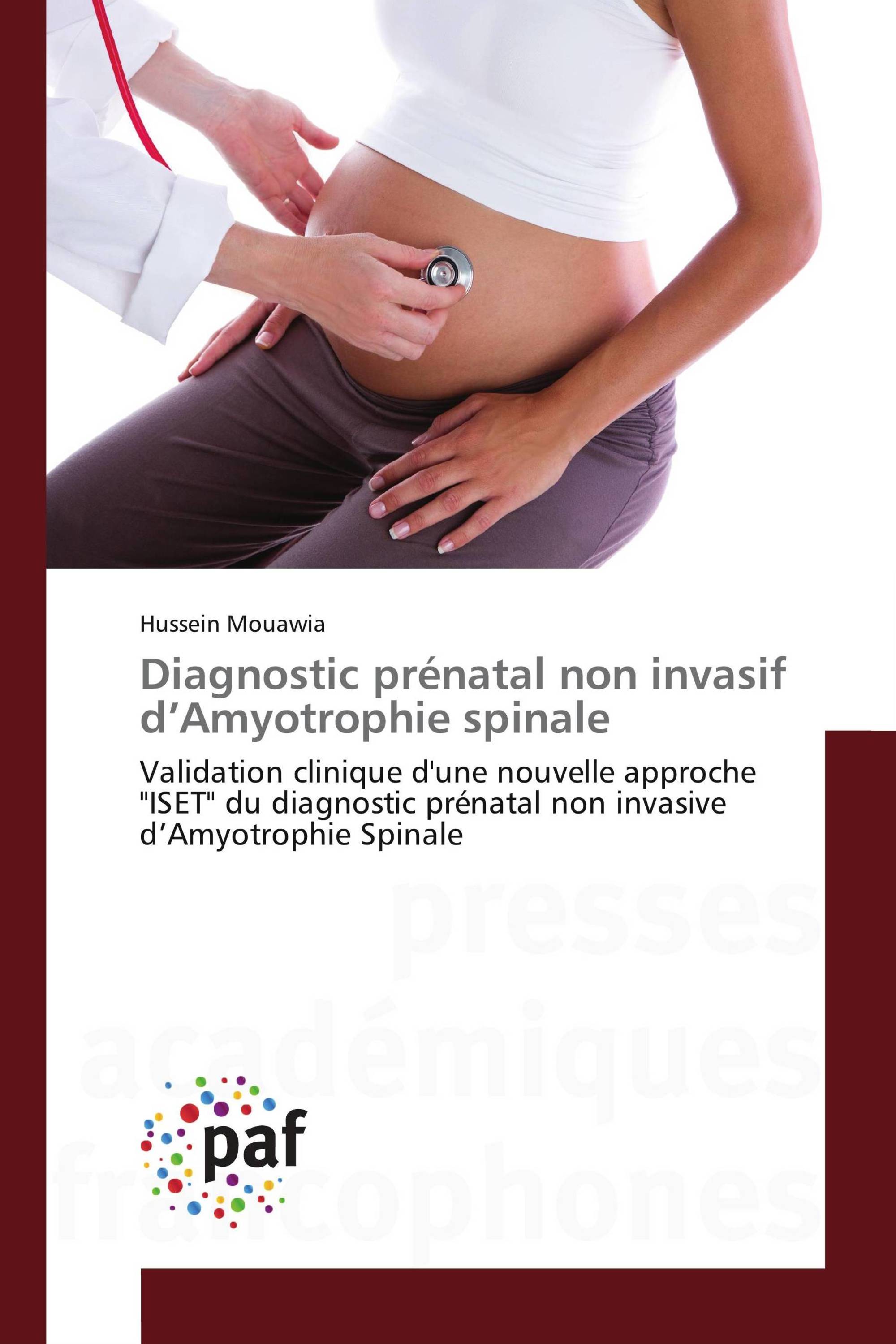 Diagnostic prénatal non invasif d’Amyotrophie spinale