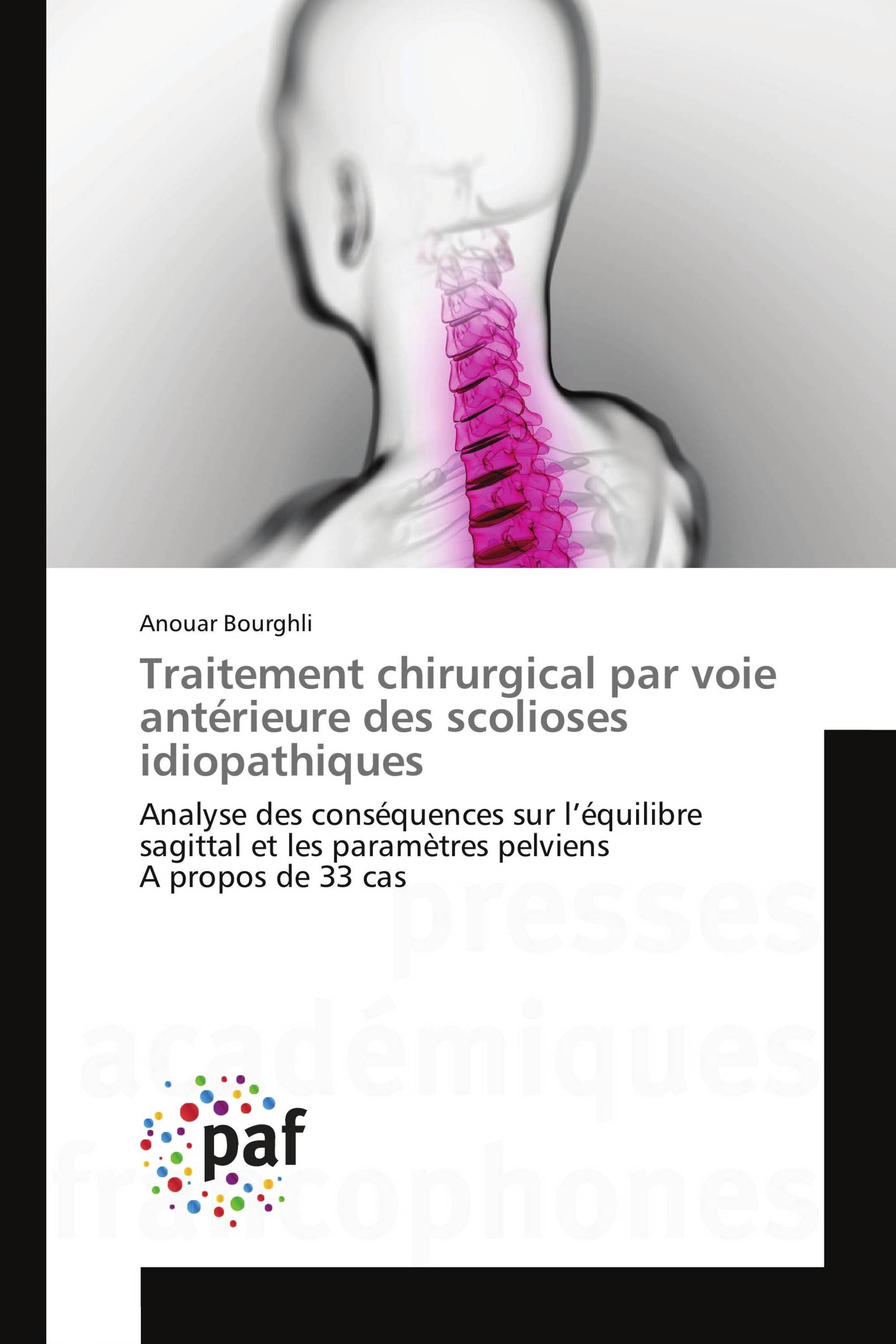 Traitement chirurgical par voie antérieure des scolioses idiopathiques