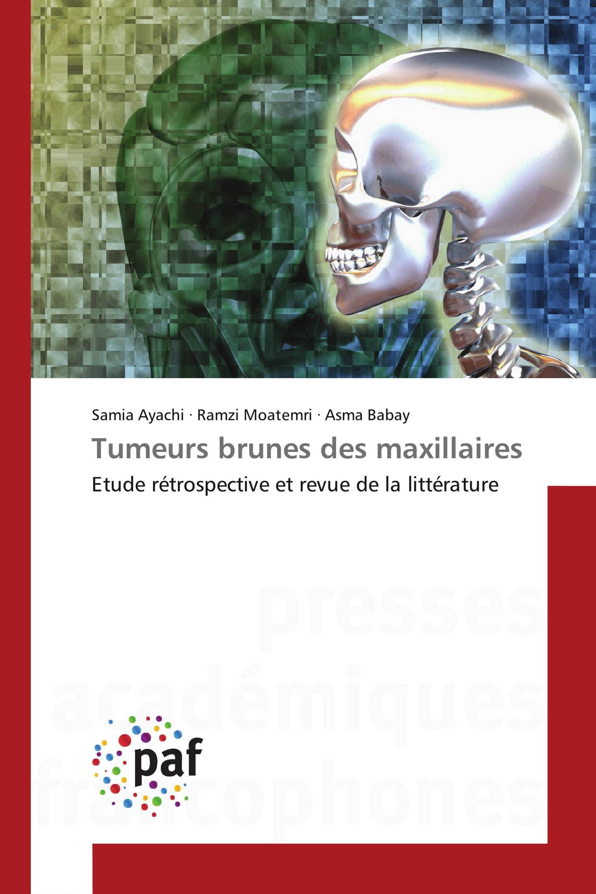 Tumeurs brunes des maxillaires