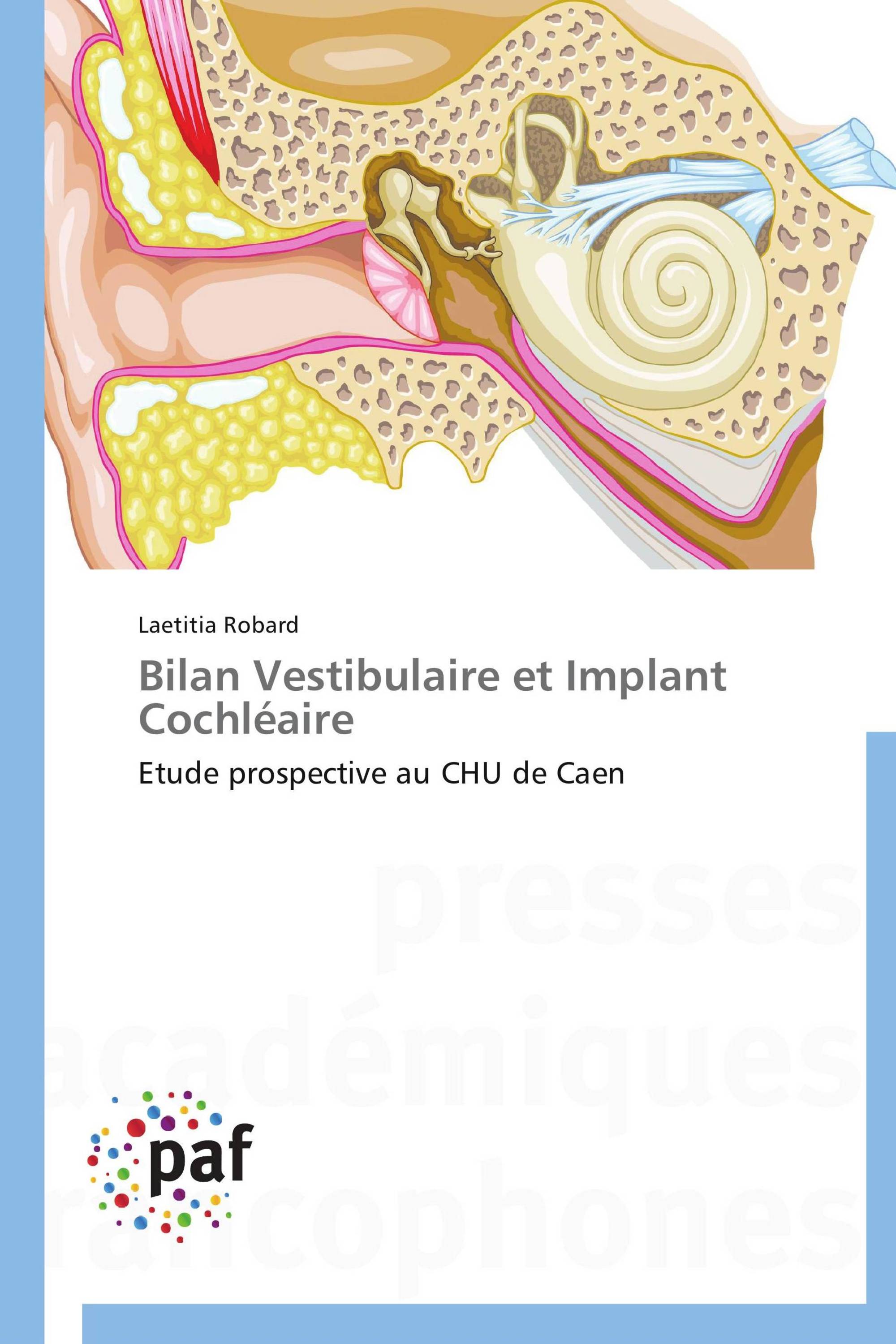 Bilan Vestibulaire et Implant Cochléaire