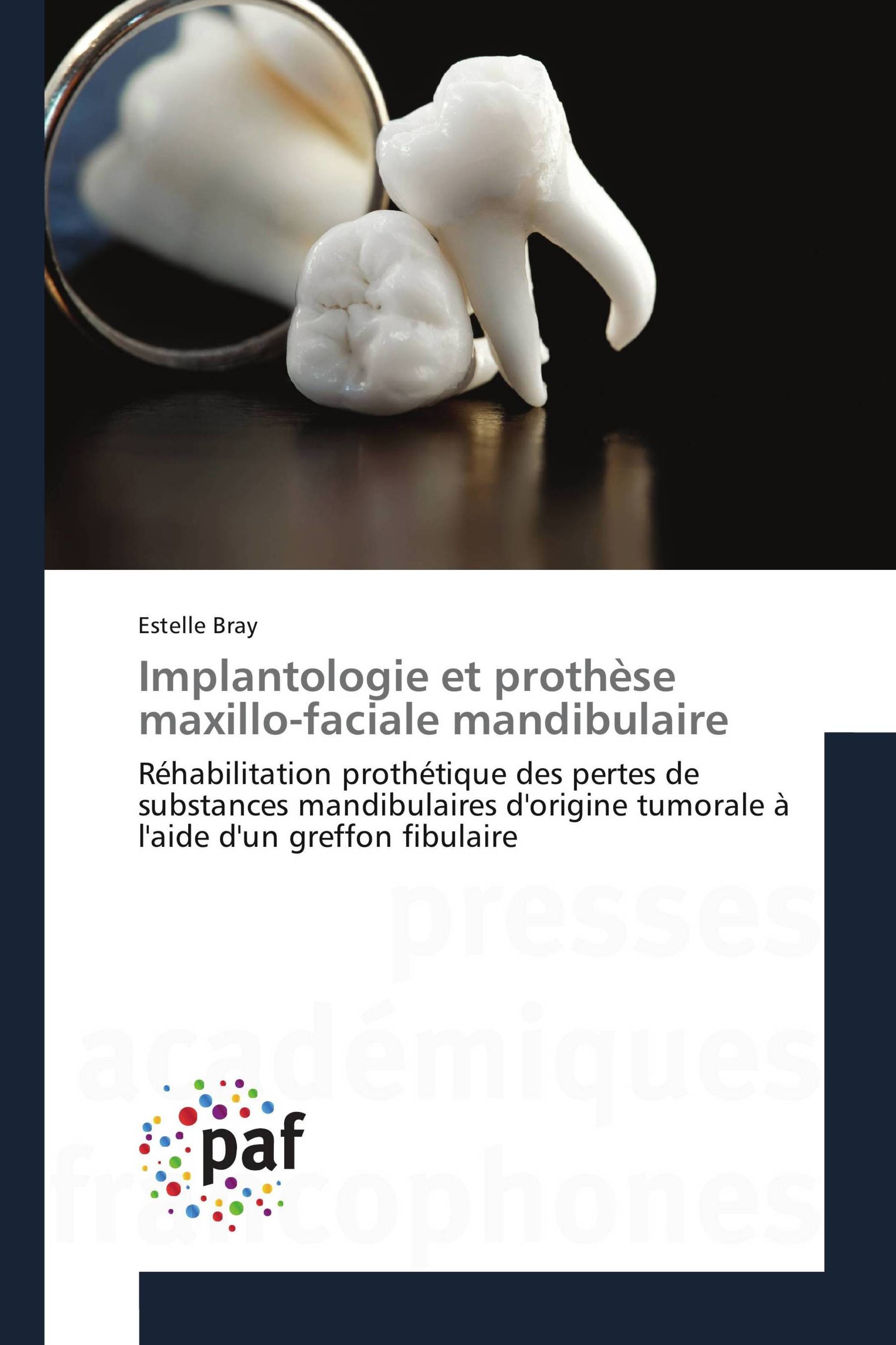 Implantologie et prothèse maxillo-faciale mandibulaire