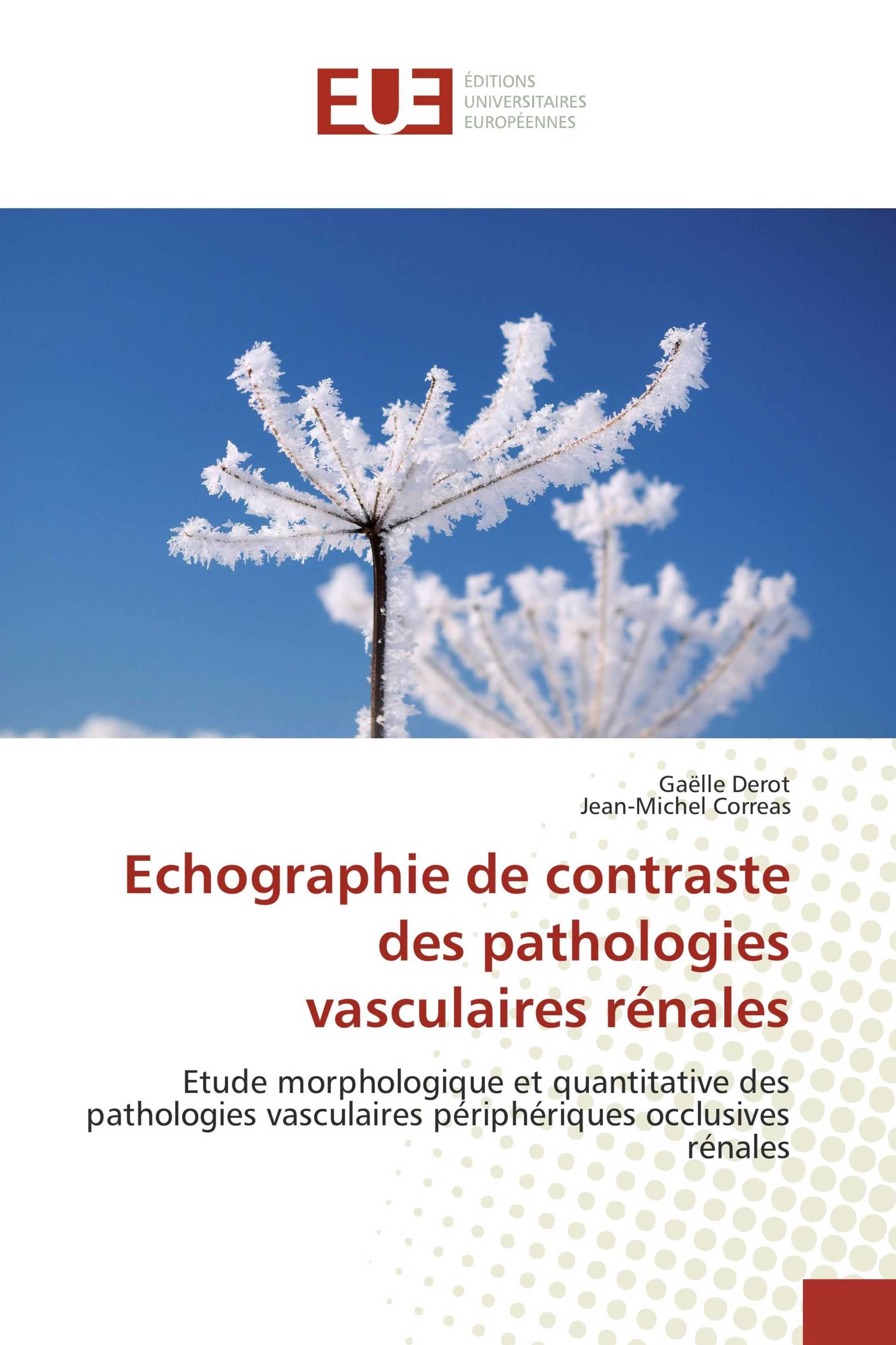 Echographie de contraste des pathologies vasculaires rénales