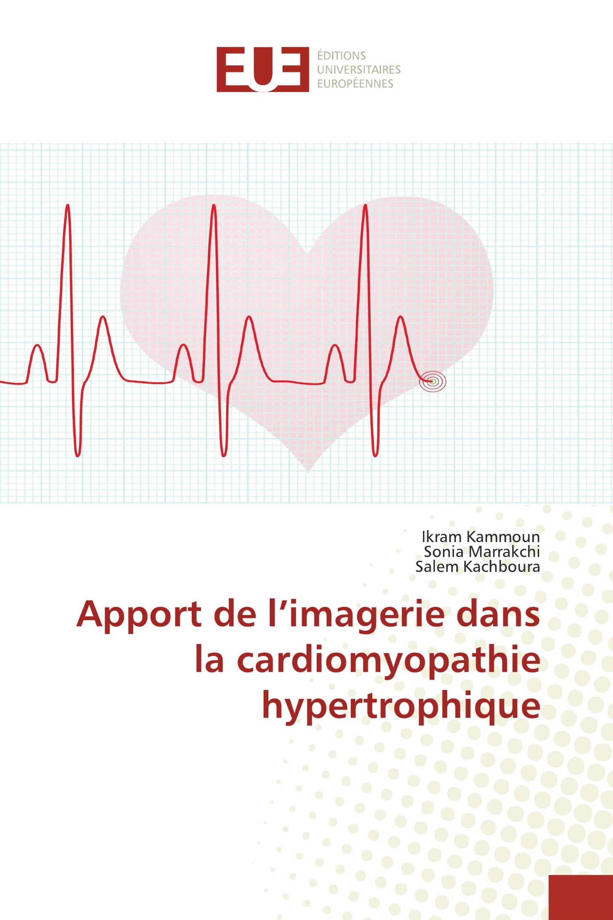 Apport de l’imagerie dans la cardiomyopathie hypertrophique