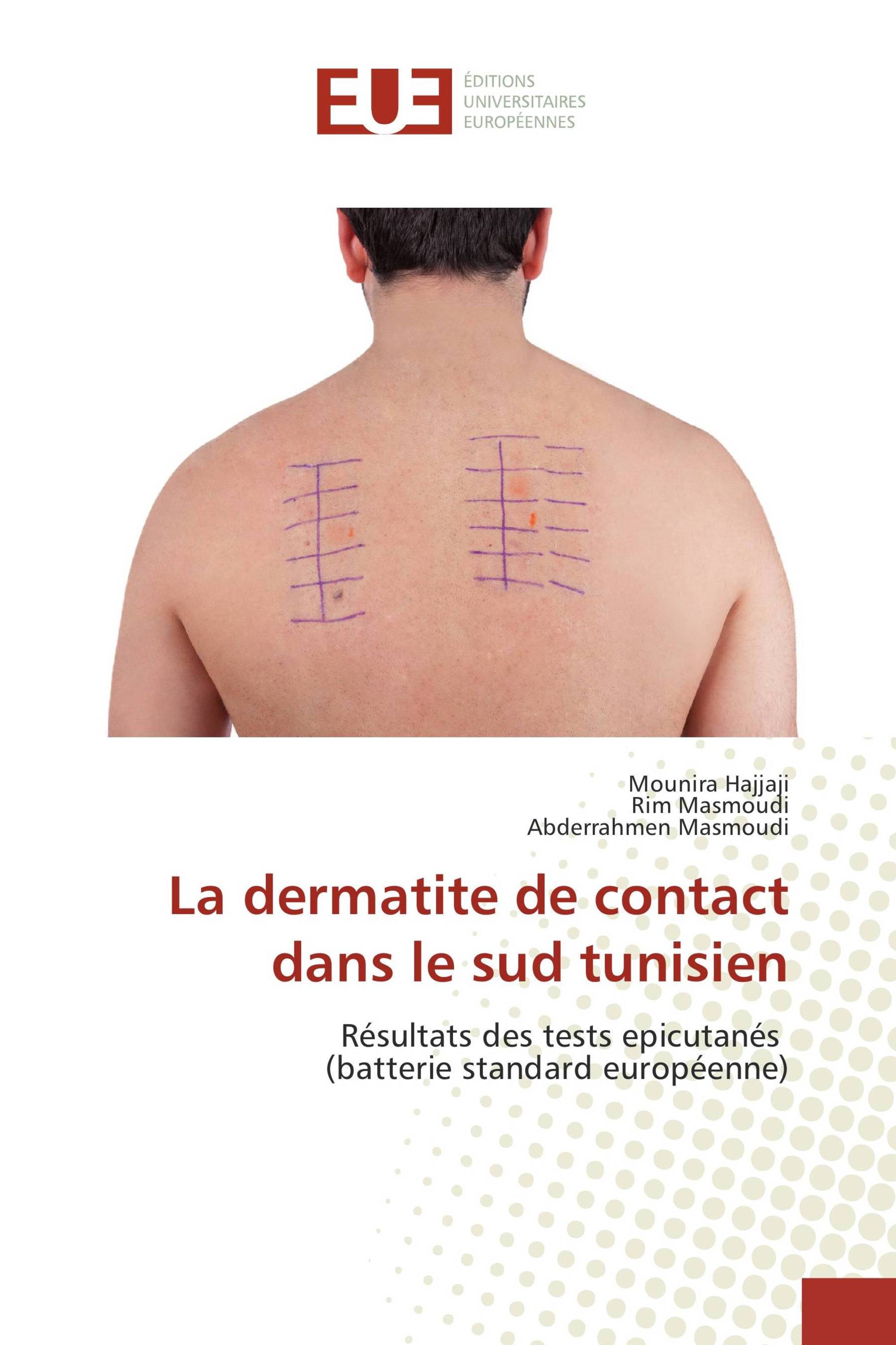 La dermatite de contact dans le sud tunisien