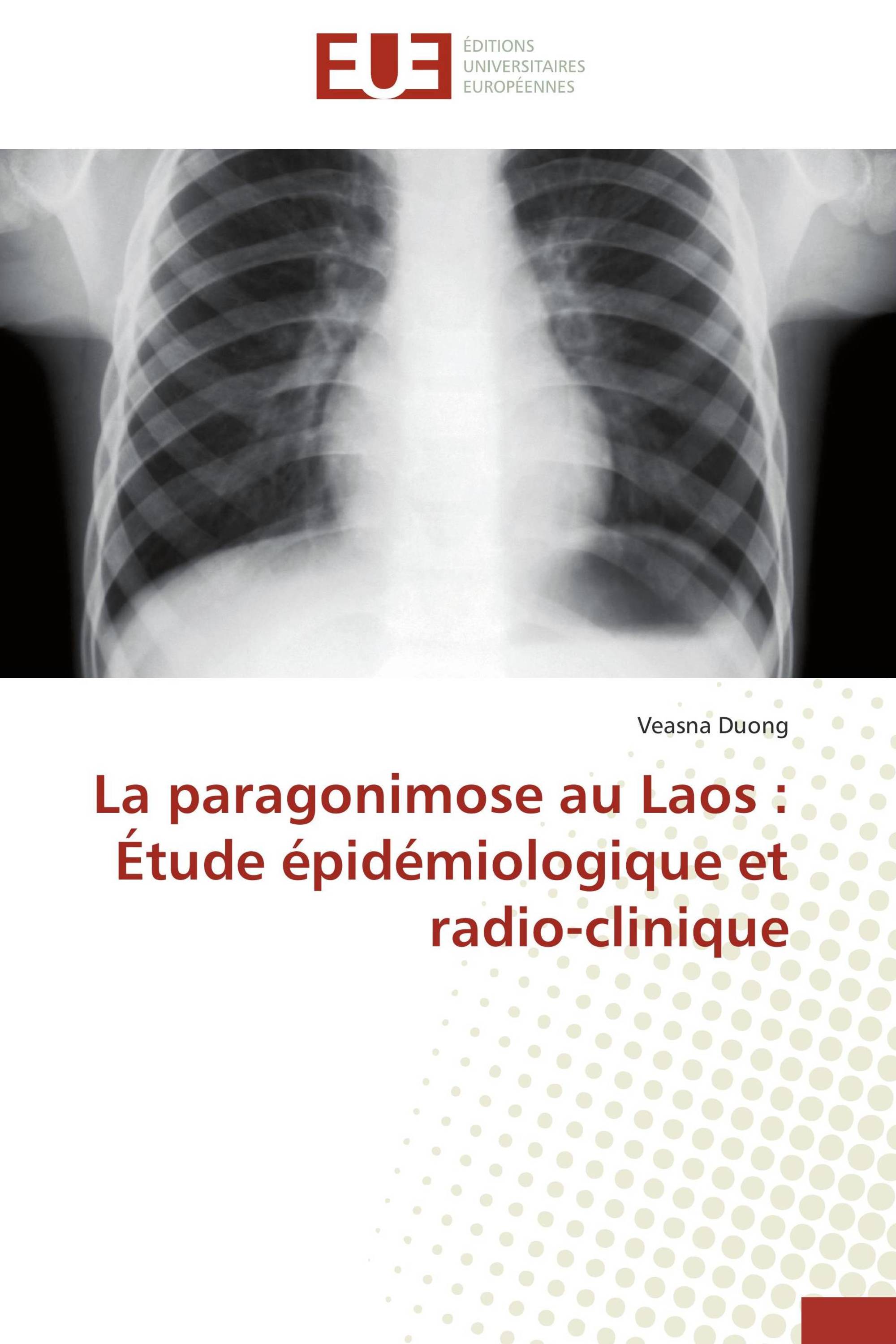 La paragonimose au Laos : Étude épidémiologique et radio-clinique