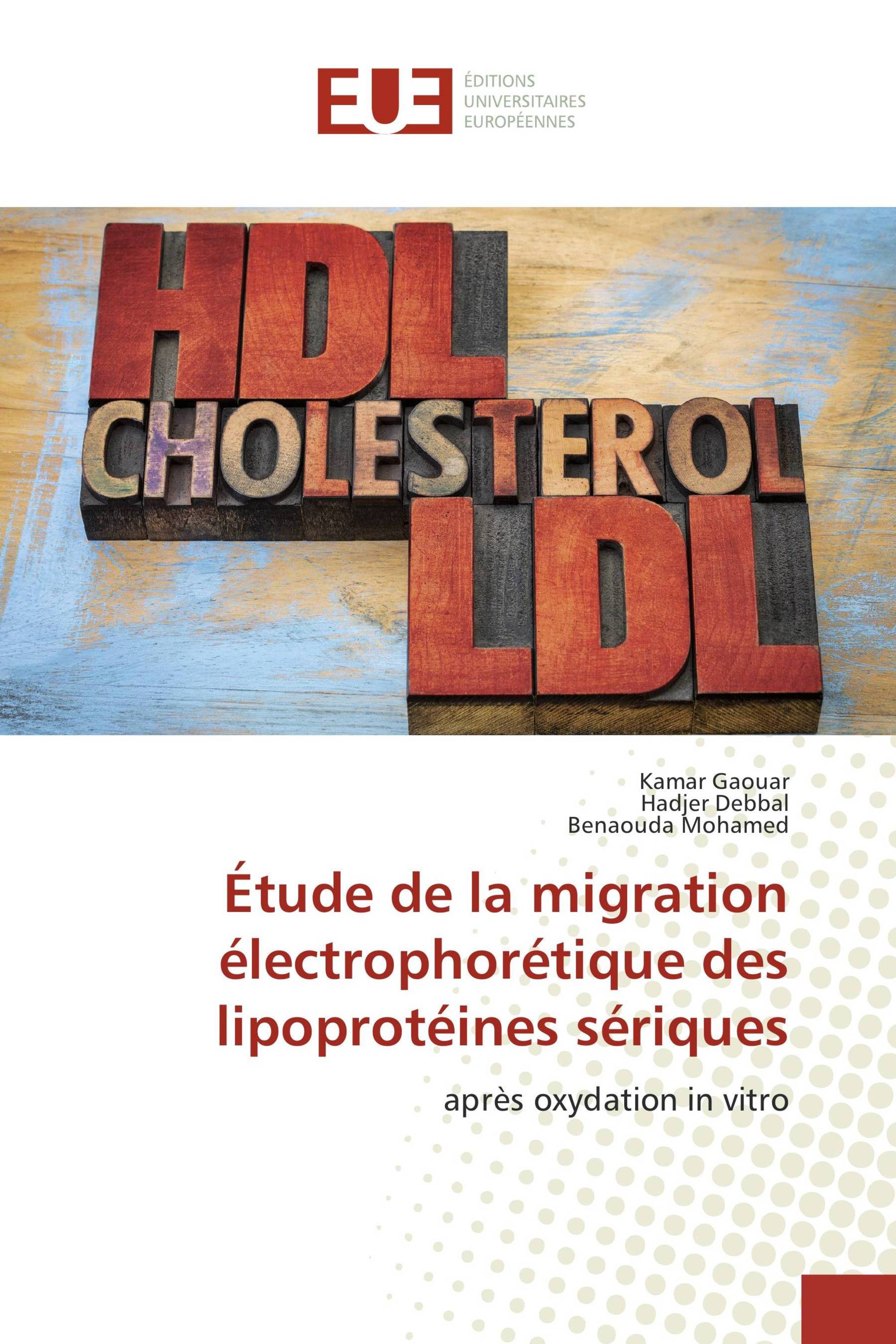 Étude de la migration électrophorétique des lipoprotéines sériques