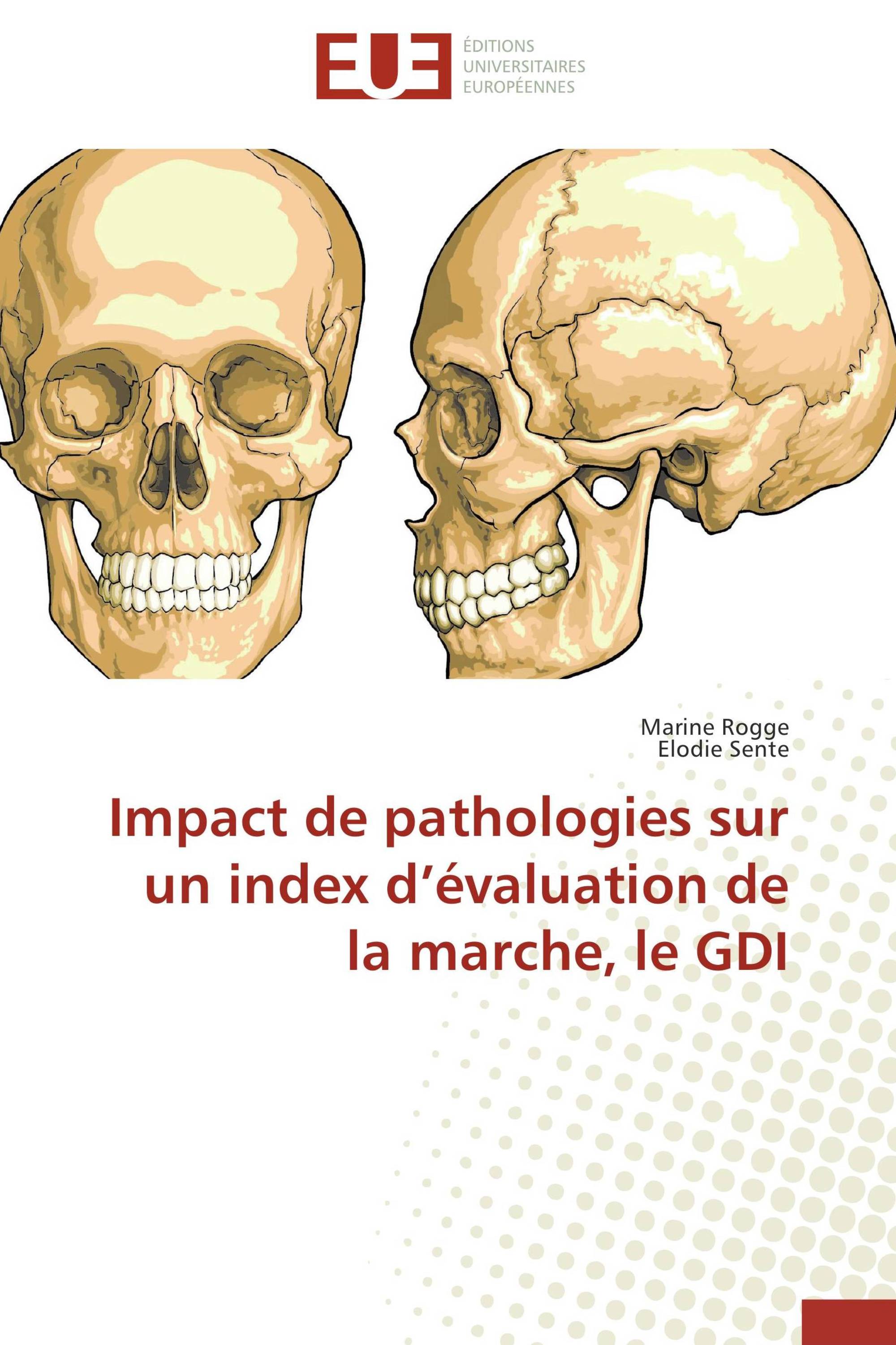 Impact de pathologies sur un index d’évaluation de la marche, le GDI