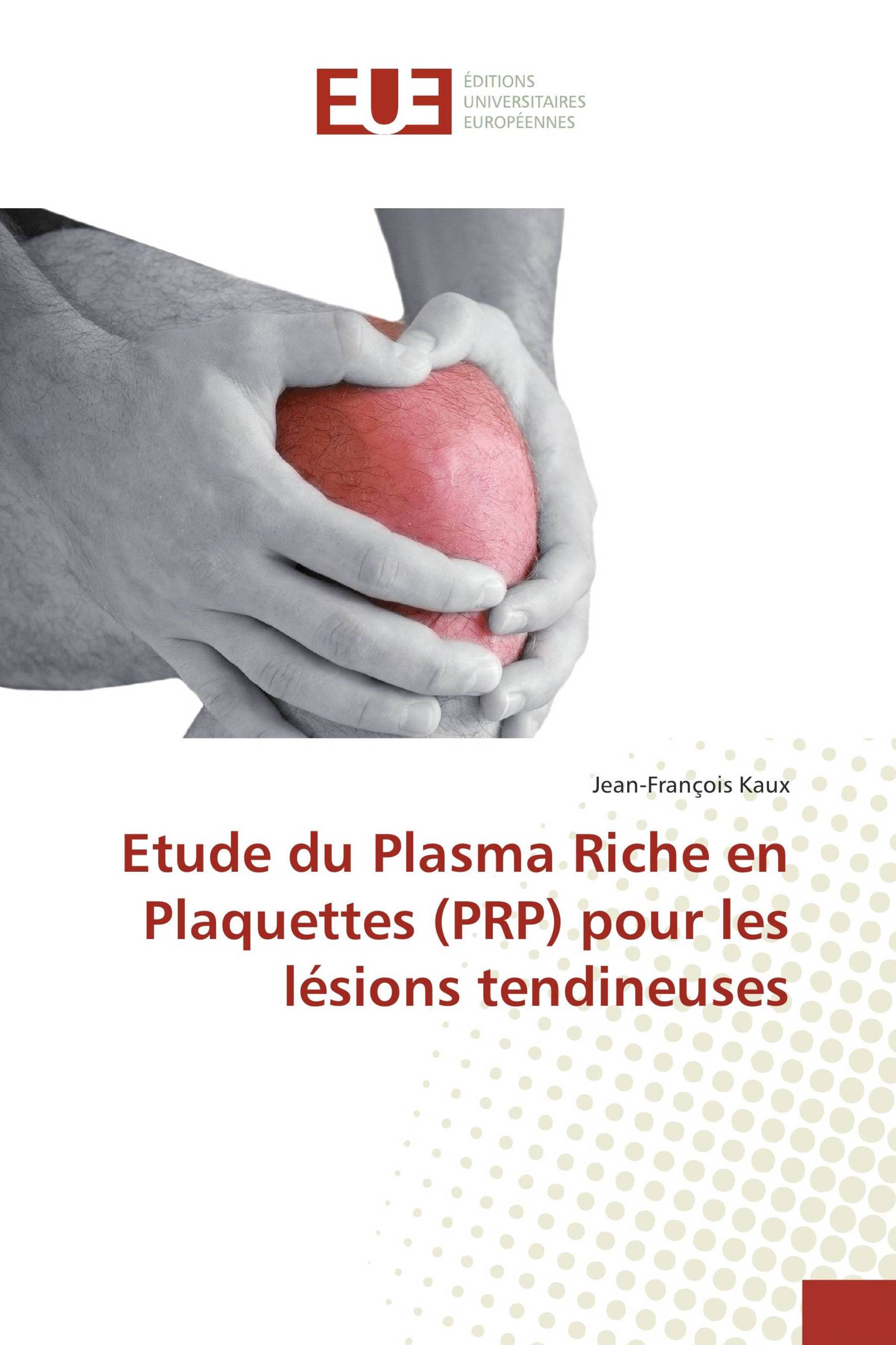 Etude du Plasma Riche en Plaquettes (PRP) pour les lésions tendineuses