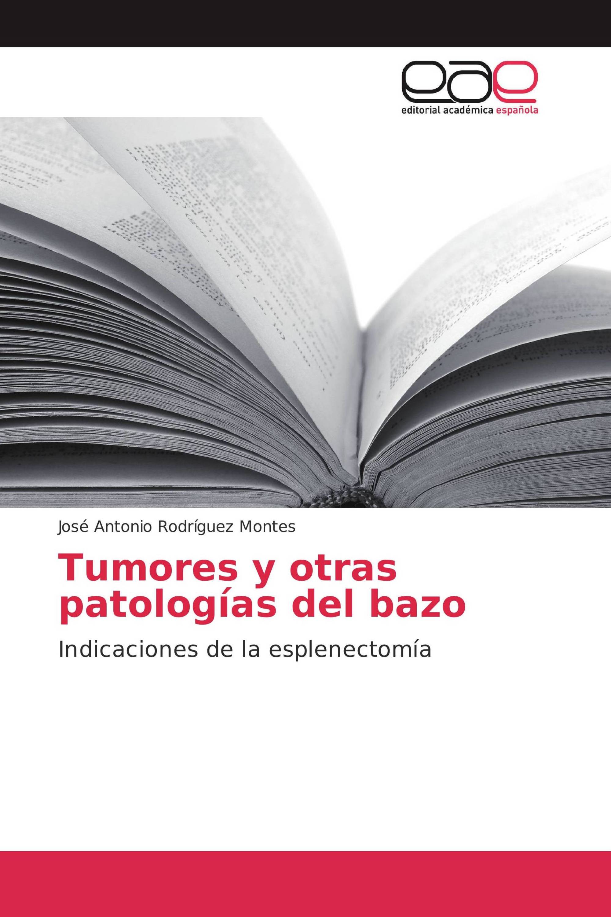 Tumores y otras patologías del bazo